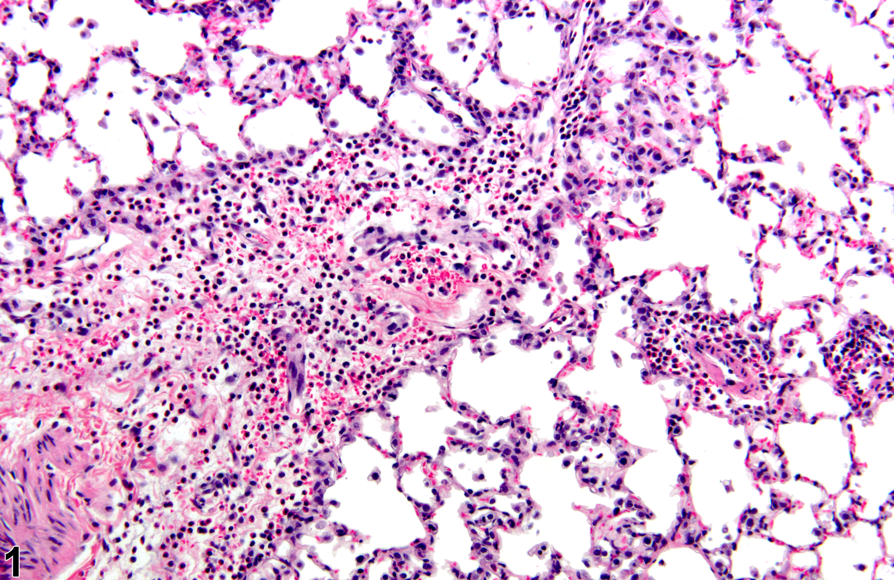 Image of acute inflammation in the lung from a male Wistar Han rat in a subchronic study