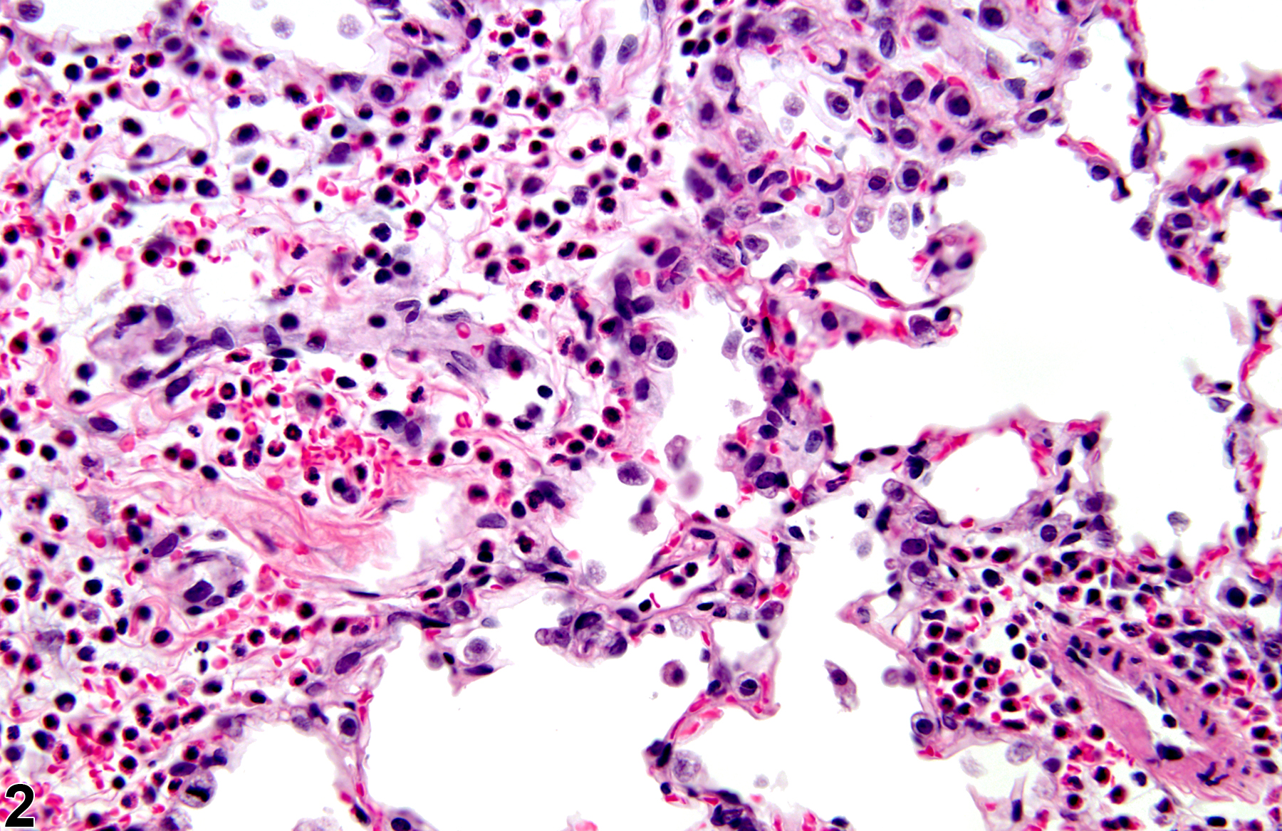 Image of acute inflammation in the lung from a male Wistar Han rat in a subchronic study