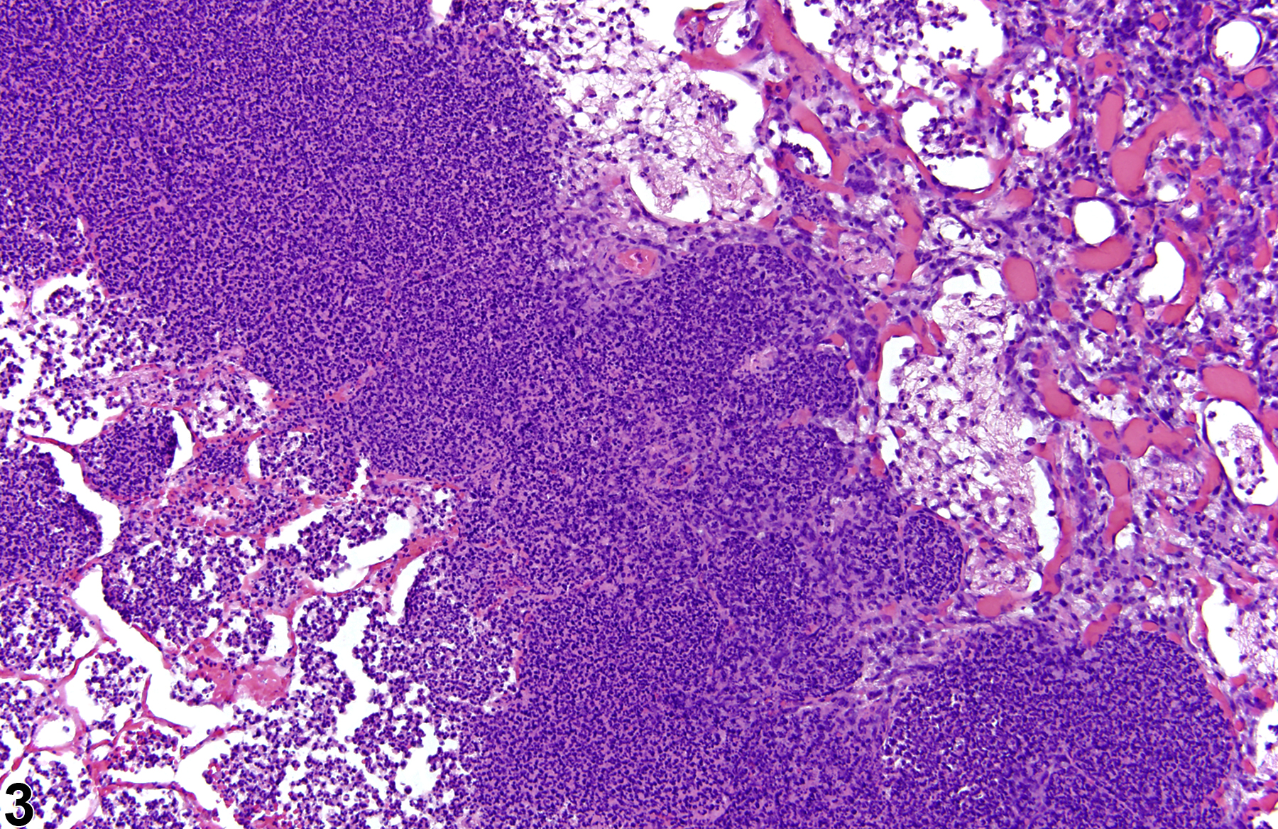 Image of suppurative inflammation in the lung from a male Wistar Han rat in a chronic study