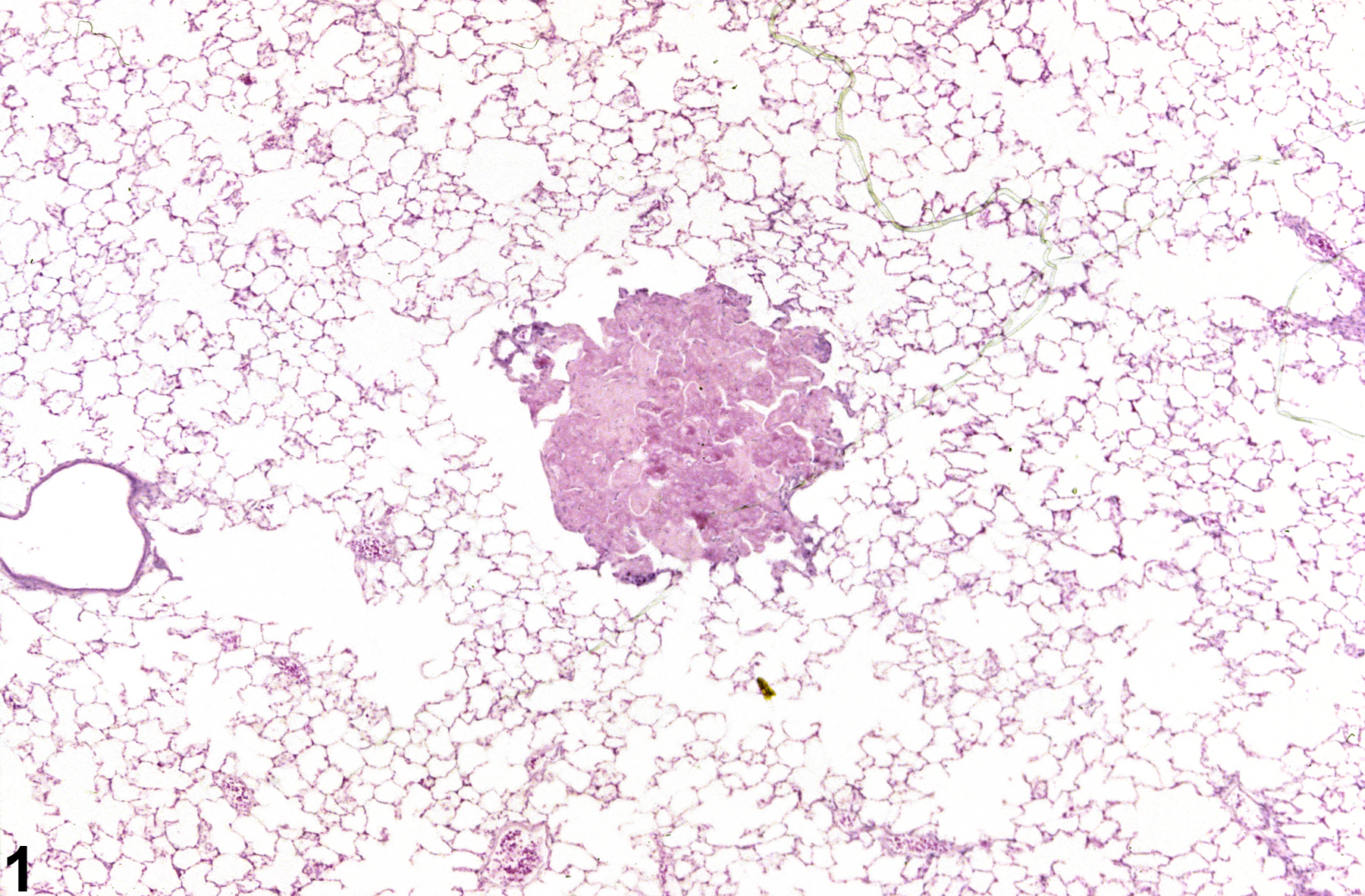 Image of osseous metaplasia in the lung from an  F344/N rat in a chronic study