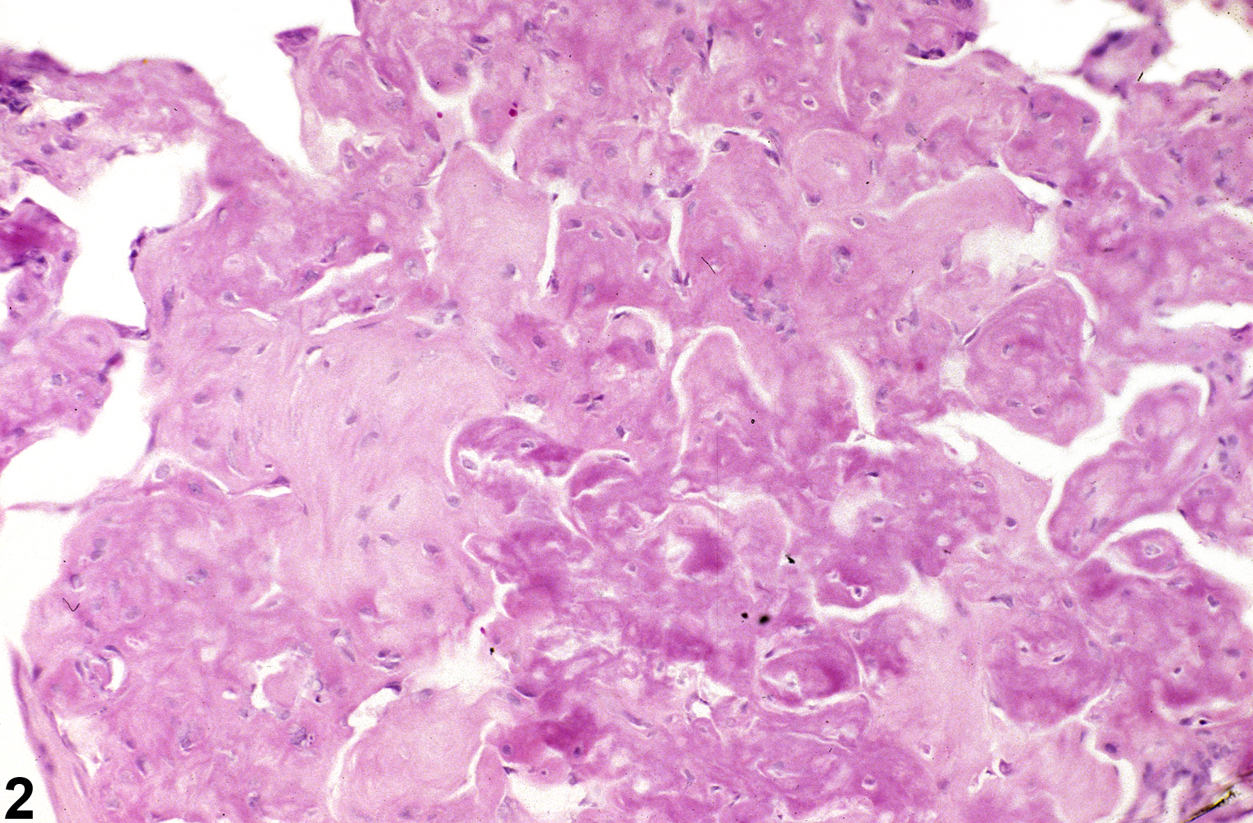 Image of osseous metaplasia in the lung from an  F344/N rat in a chronic study