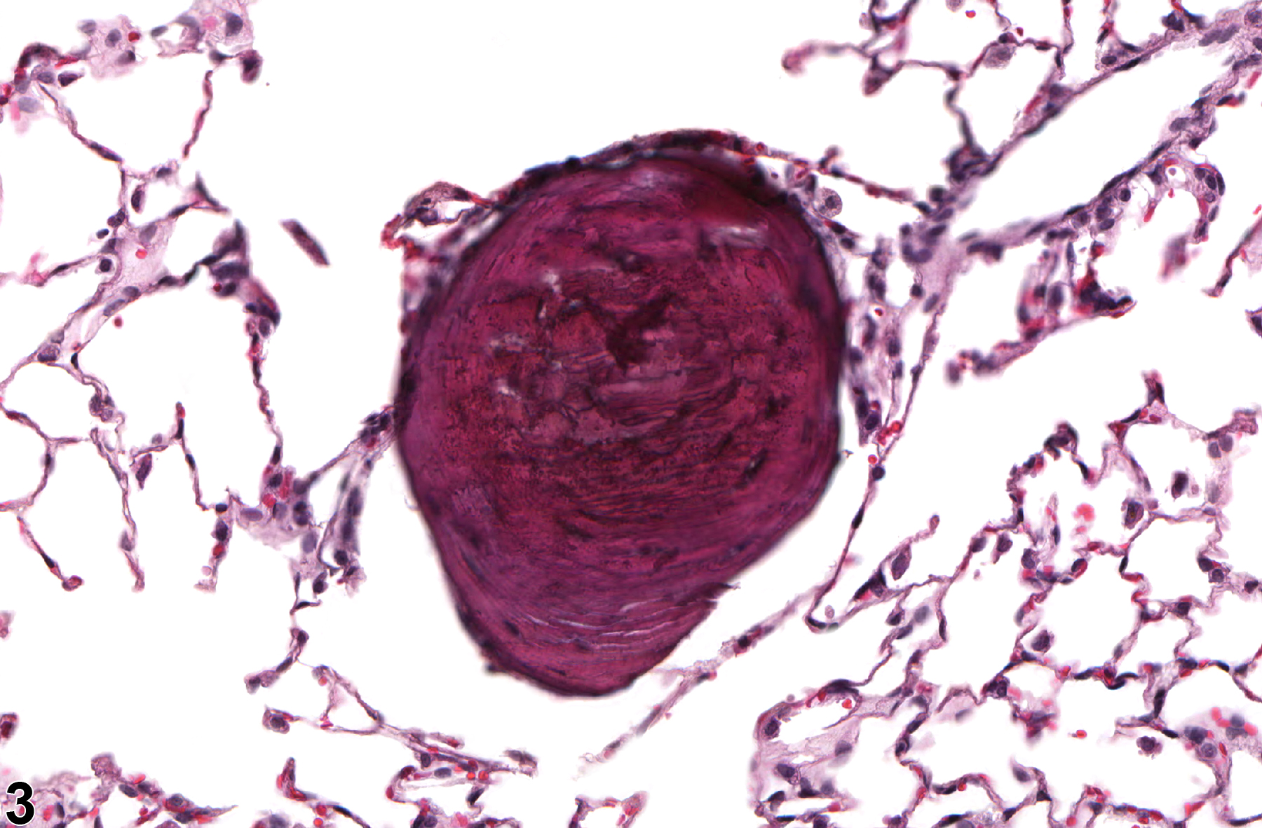 Image of osseous metaplasia in the lung from a male F344/N rat in a chronic study