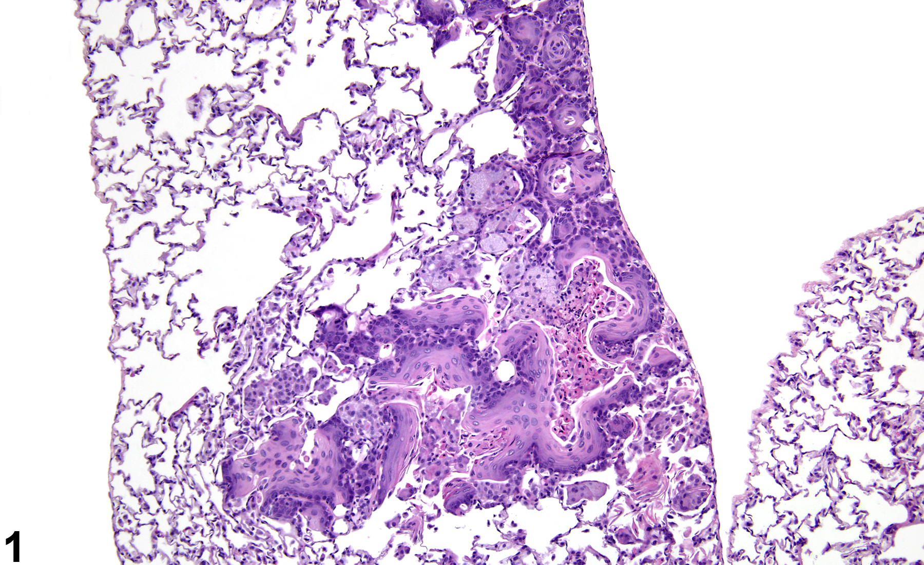 Image of alveolar squamous metaplasia in the lung from a female Harlan Sprague-Dawley rat in a subchronic study