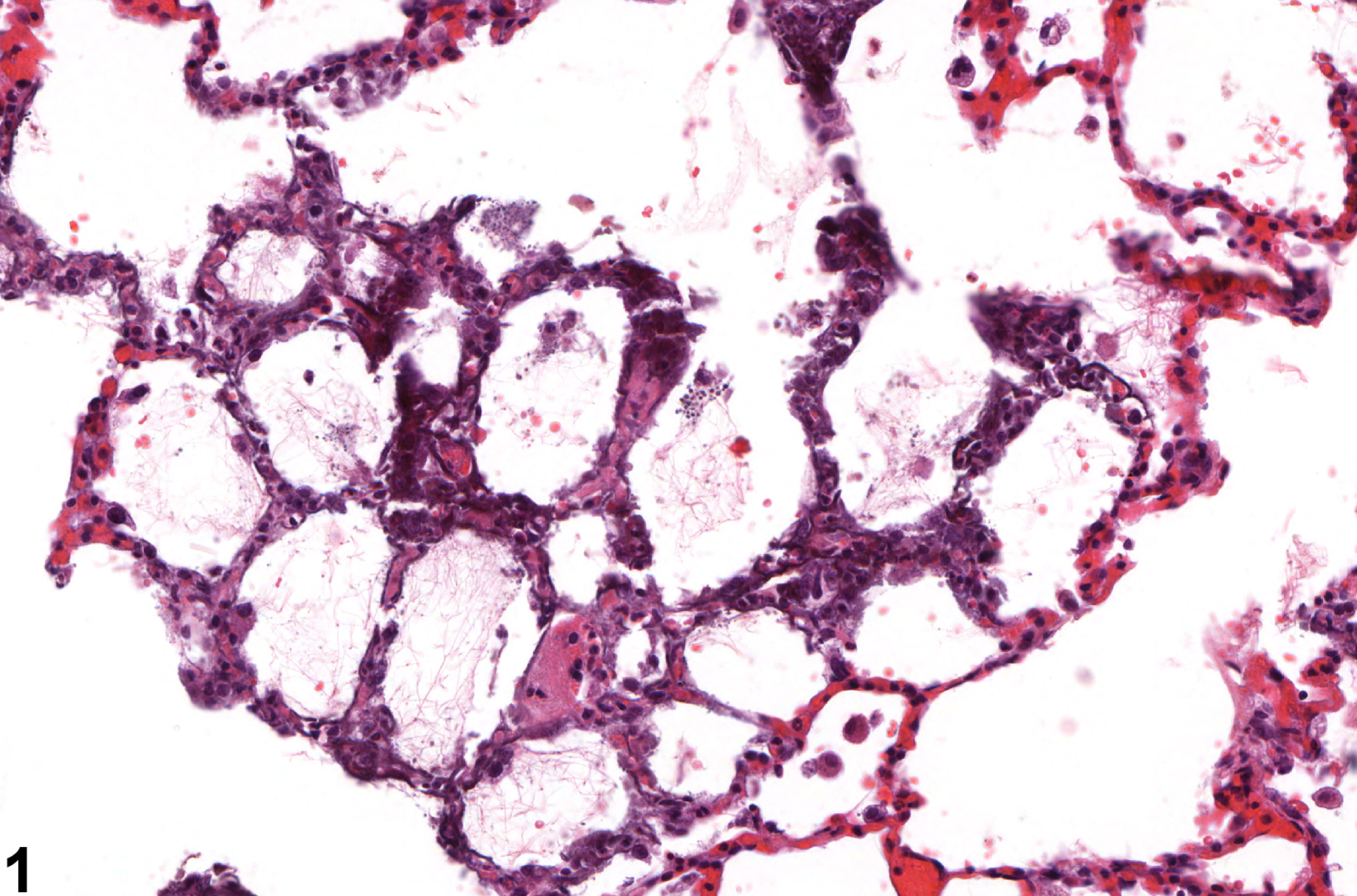 Image of interstitial mineral in the lung from a male F344/N rat in a chronic study