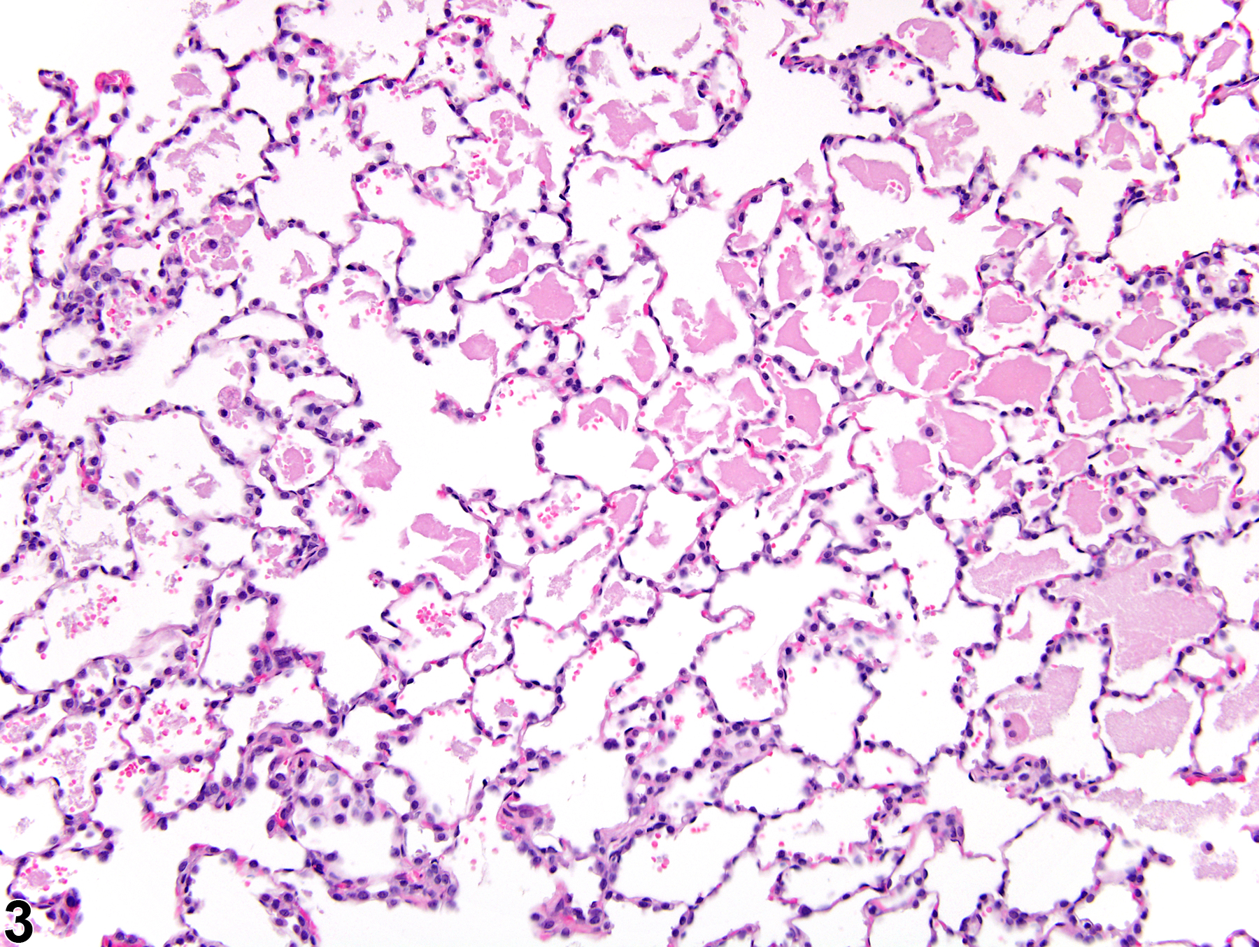 Image of alveolar proteinosis in the lung from a male F344/N rat in a subchronic study