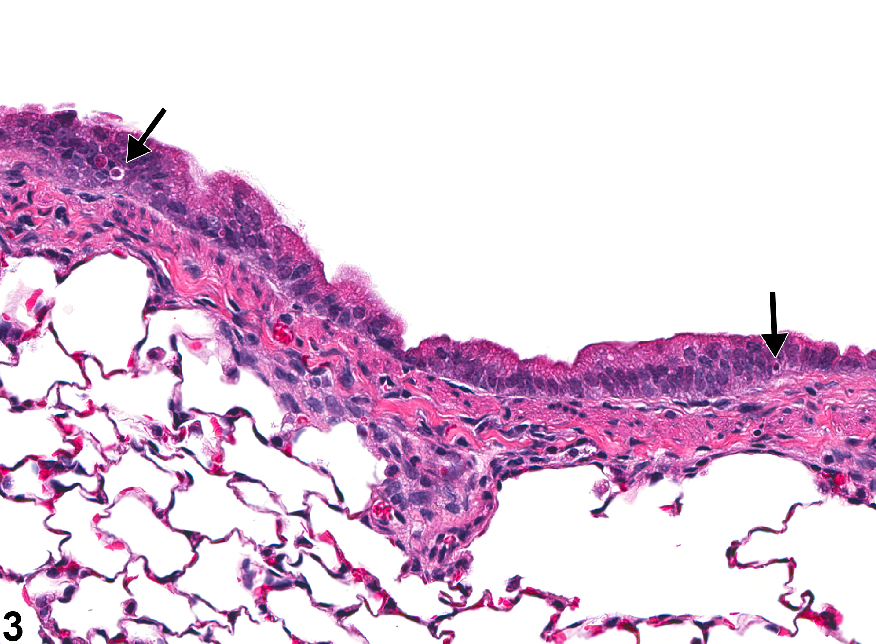 Image of bronchiolar regeneration in the lung from a male Wistar Han rat in a acute study