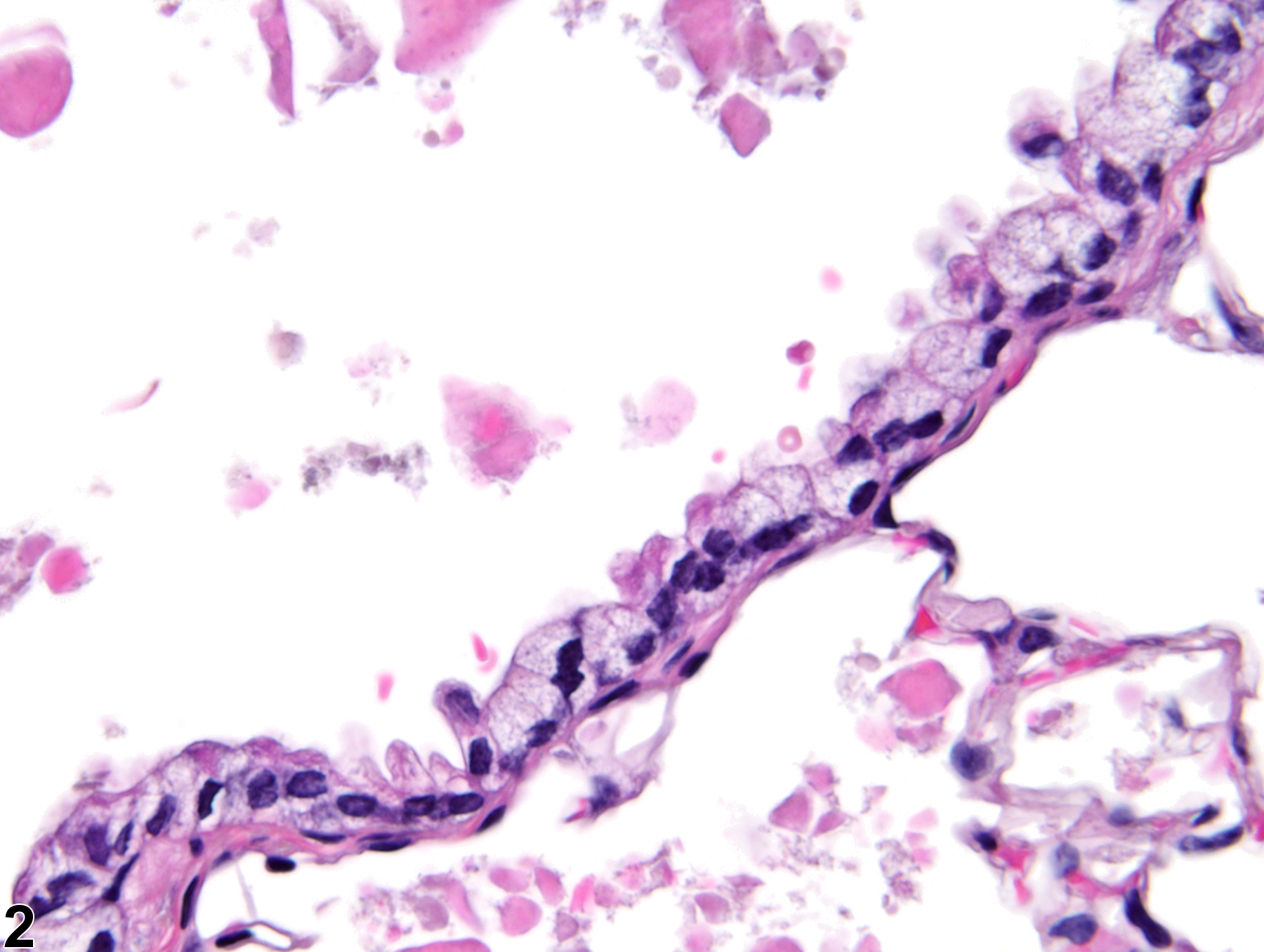 Image of bronchiolar vacuolization, cytoplasmic in the lung from a female B6C3F1/N mouse in a chronic study