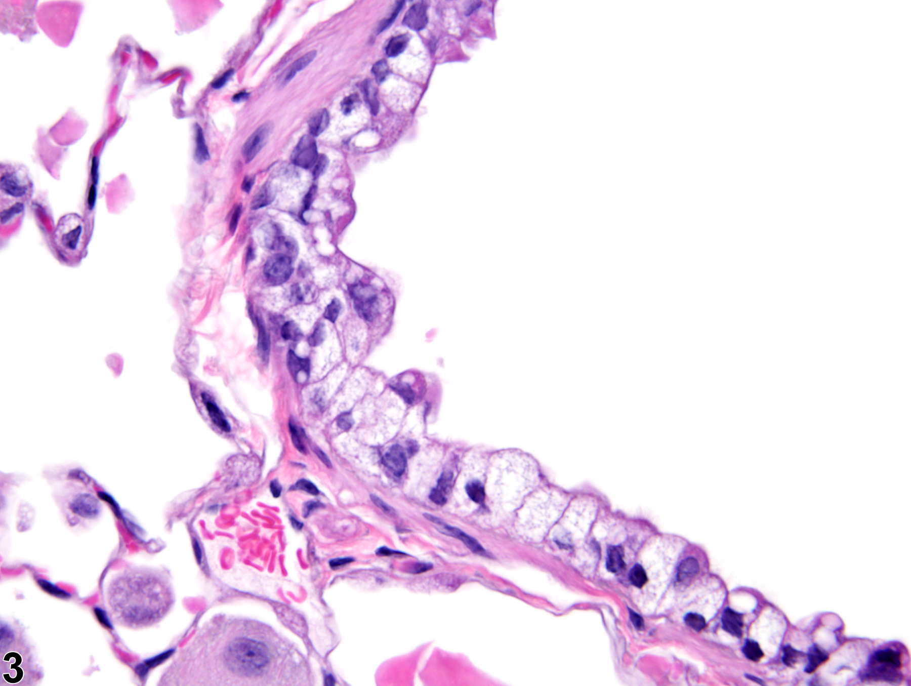 Image of bronchiolar vacuolization, cytoplasmic in the lung from a female B6C3F1/N mouse in a chronic study