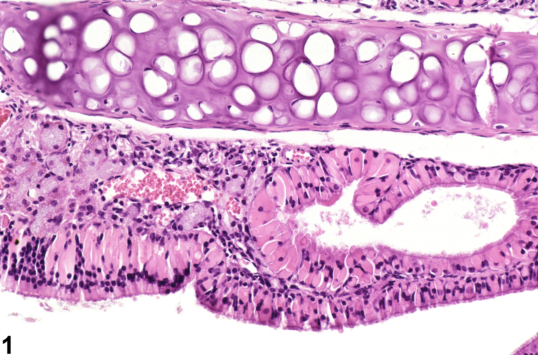 Image of accumulation, hyaline droplet in the nose, respiratory epithelium from a female B6C3F1/N mouse in a chronic study