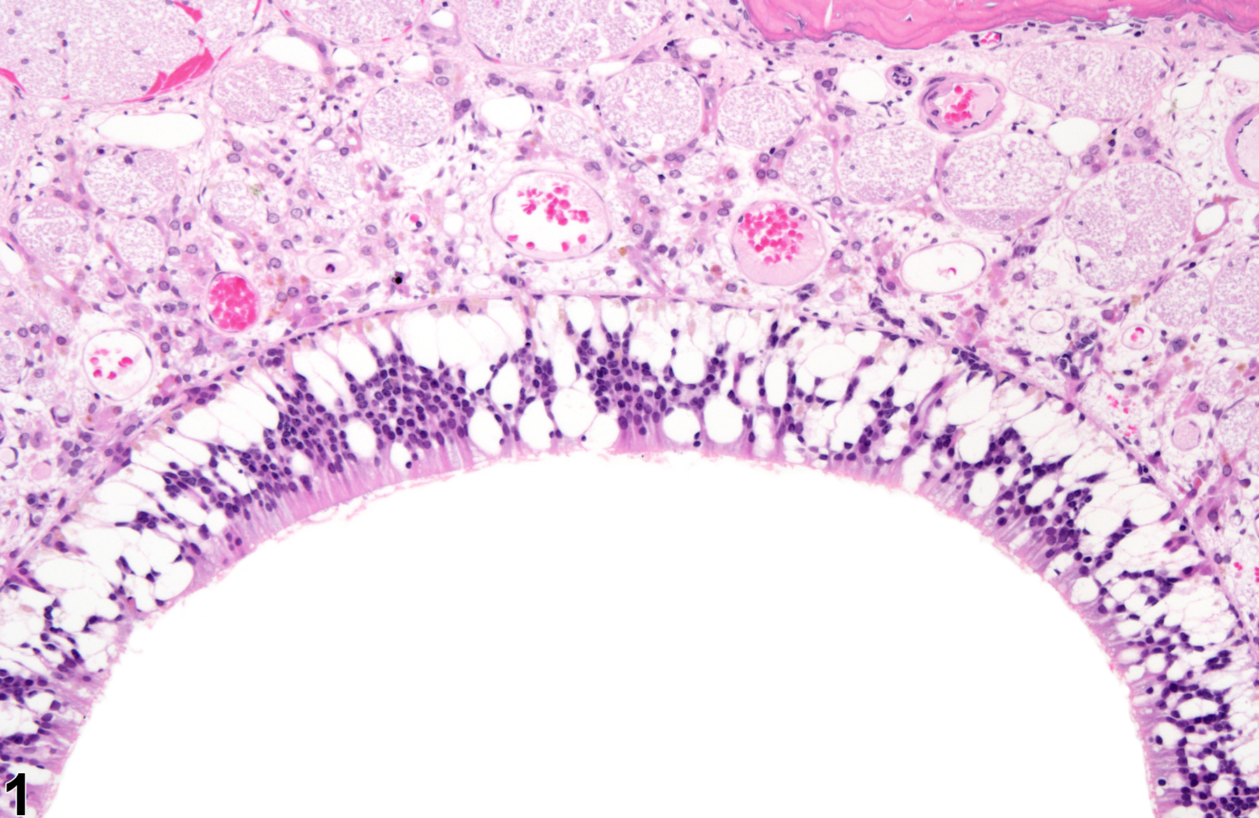 Image of degeneration in the nose, olfactory epithelium from a male F344/N rat in a chronic study