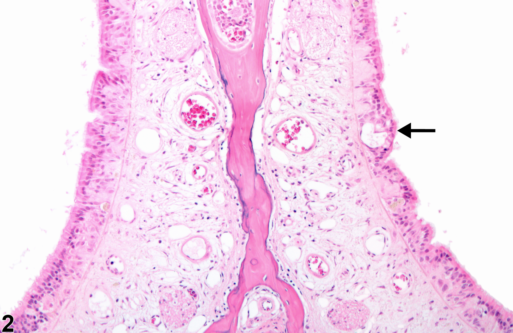 Image of degeneration in the nose, olfactory epithelium from a female B6C3F1/N mouse in a chronic study