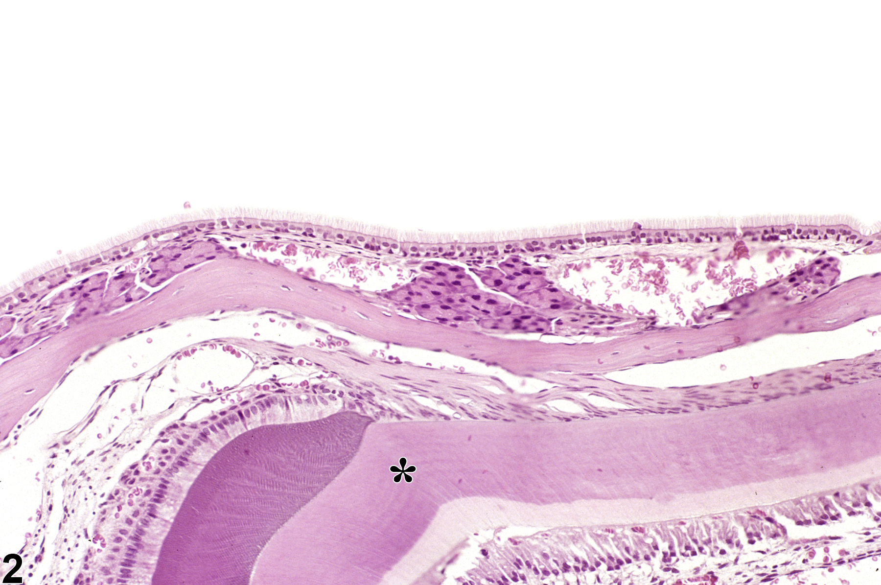 Image of normal in the nose, transitional epithelium from a male B6C3F1/N mouse in a chronic study