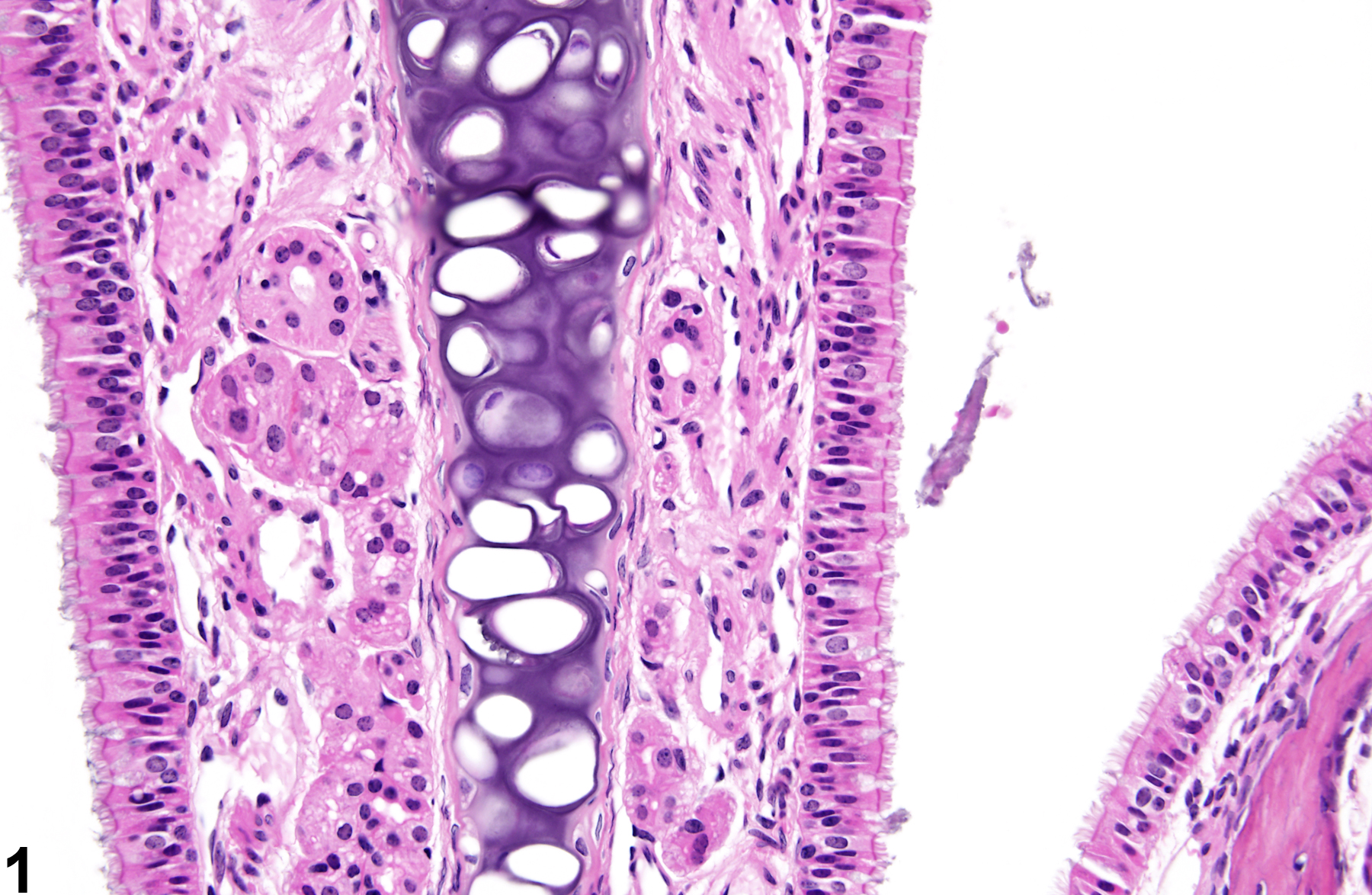 Image of normal in the nose, respiratory epithelium from a male B6C3F1/N mouse in a subchronic study