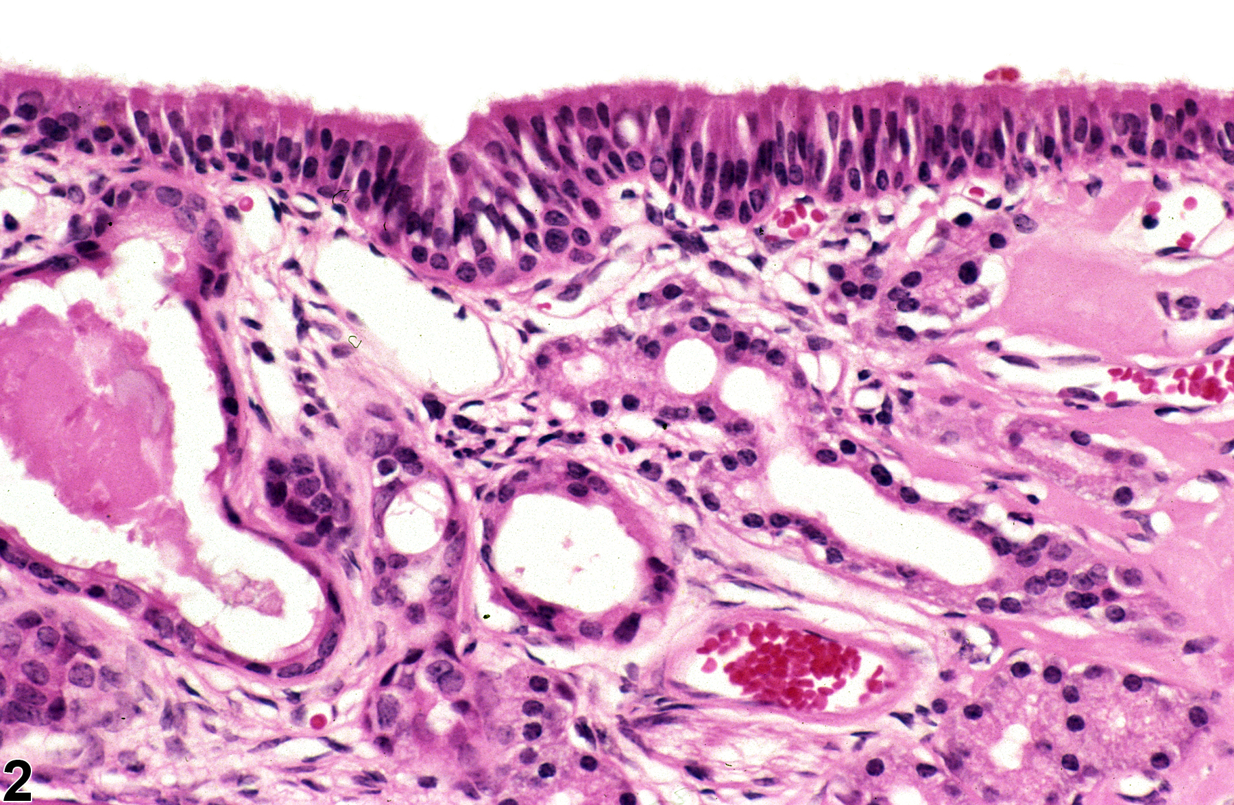 Image of hyperplasia in the nose, respiratory epithelium from a female B6C3F1/N mouse in a chronic study