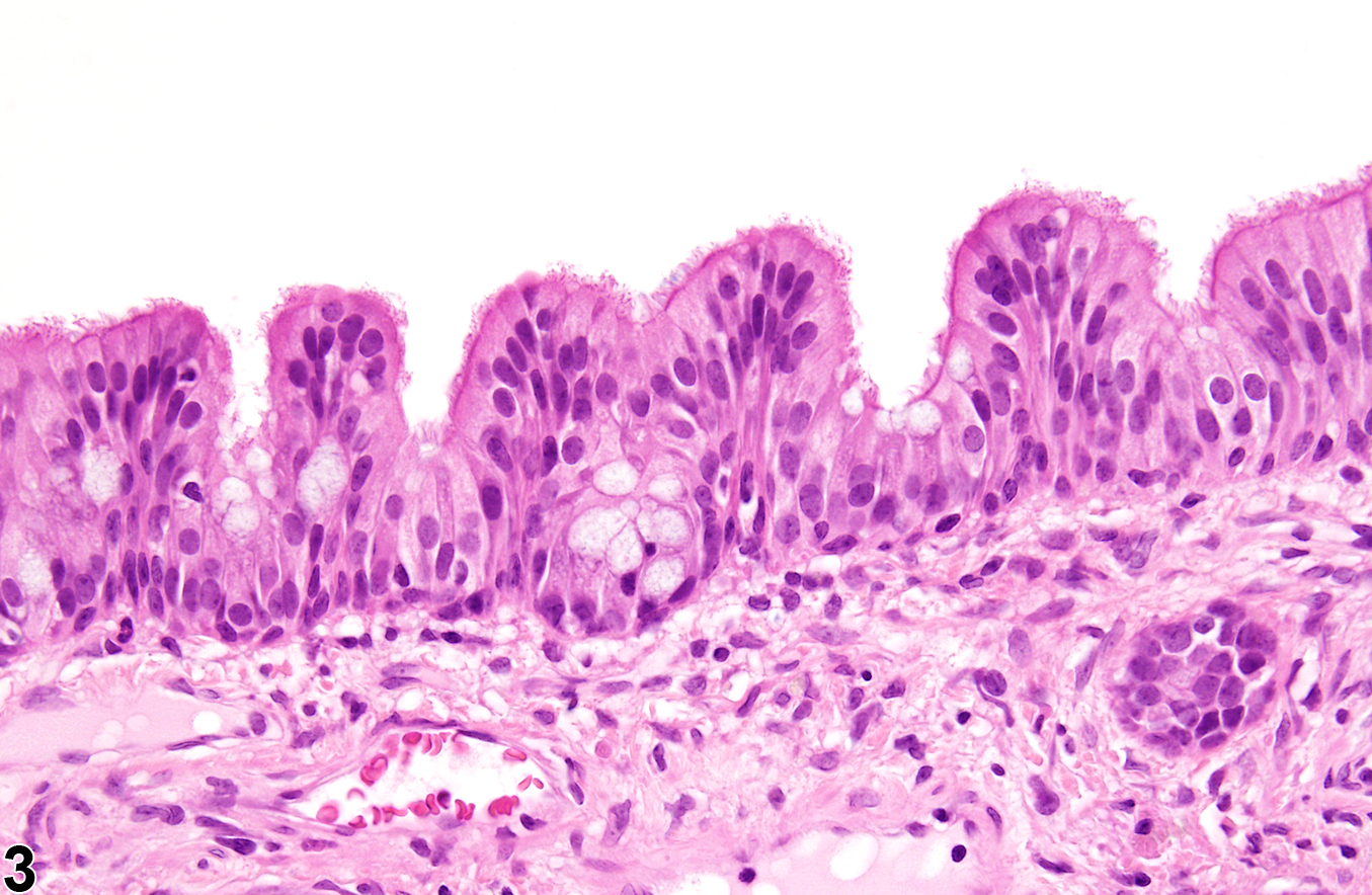 Image of hyperplasia in the nose, respiratory epithelium from a female Harlan Sprague-Dawley rat in a chronic study