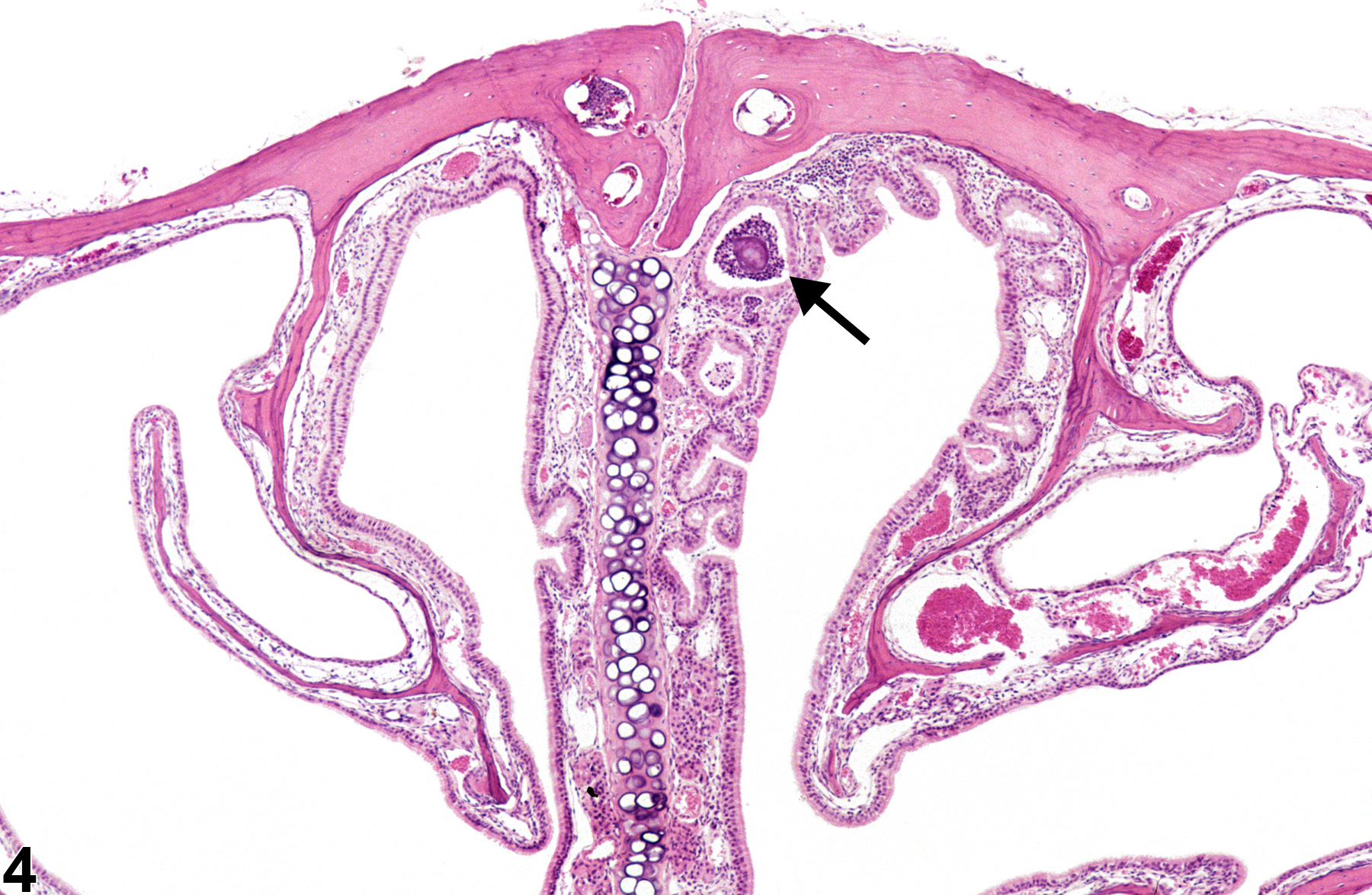 Image of hyperplasia in the nose, respiratory epithelium from a male B6C3F1/N mouse in a chronic study