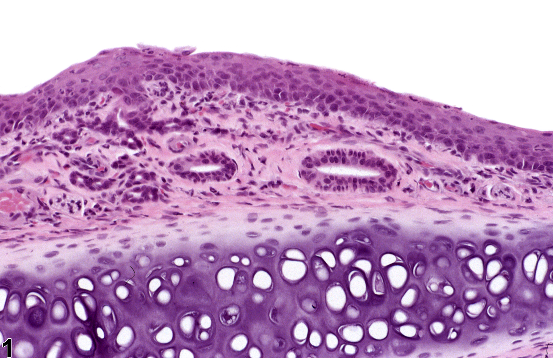 Image of metaplasia, squamous in the nose, respiratory epithelium from a male F344/N rat in a chronic study