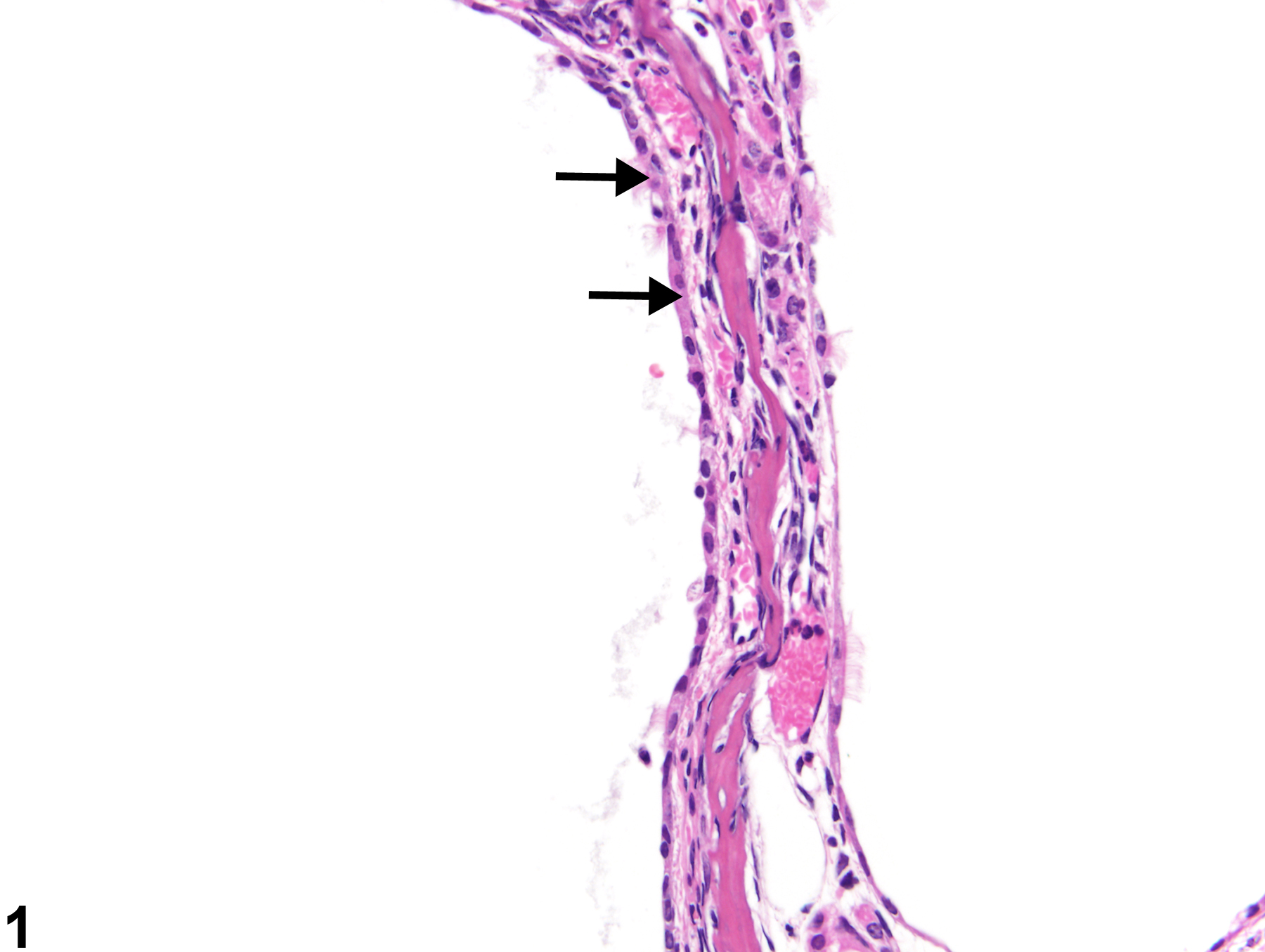 Image of regeneration in the nose, respiratory epithelium from a female B6C3F1/N mouse in a chronic study