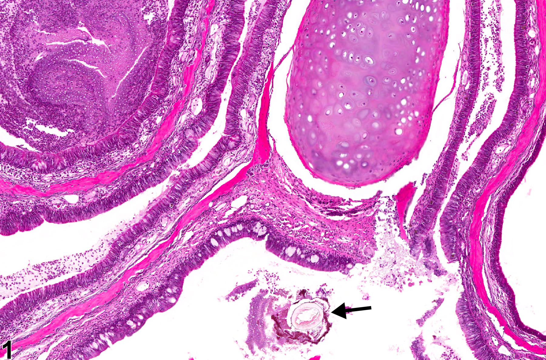 Image of foreign body in the nose from a female F344/N rat in a chronic study