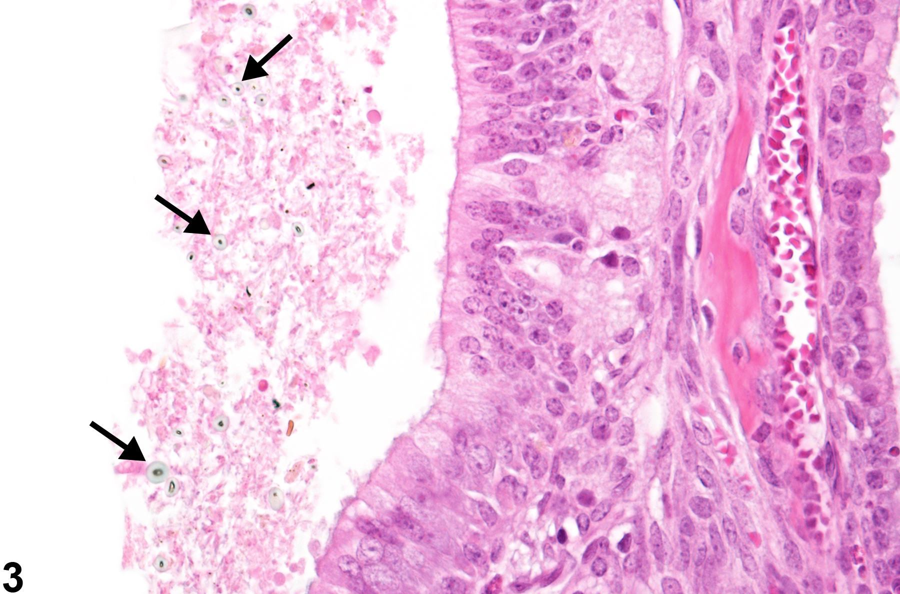 Image of foreign body in the nose from a female B6C3F1/N mouse in a subchronic study