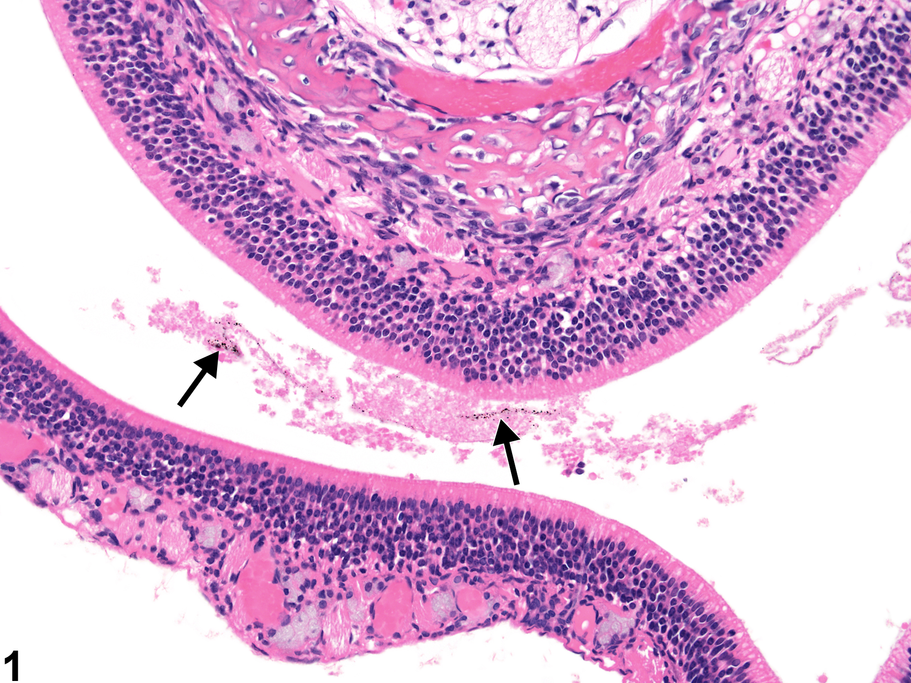 Image of foreign material in the nose from a female F344/Ntac rat in an acute study