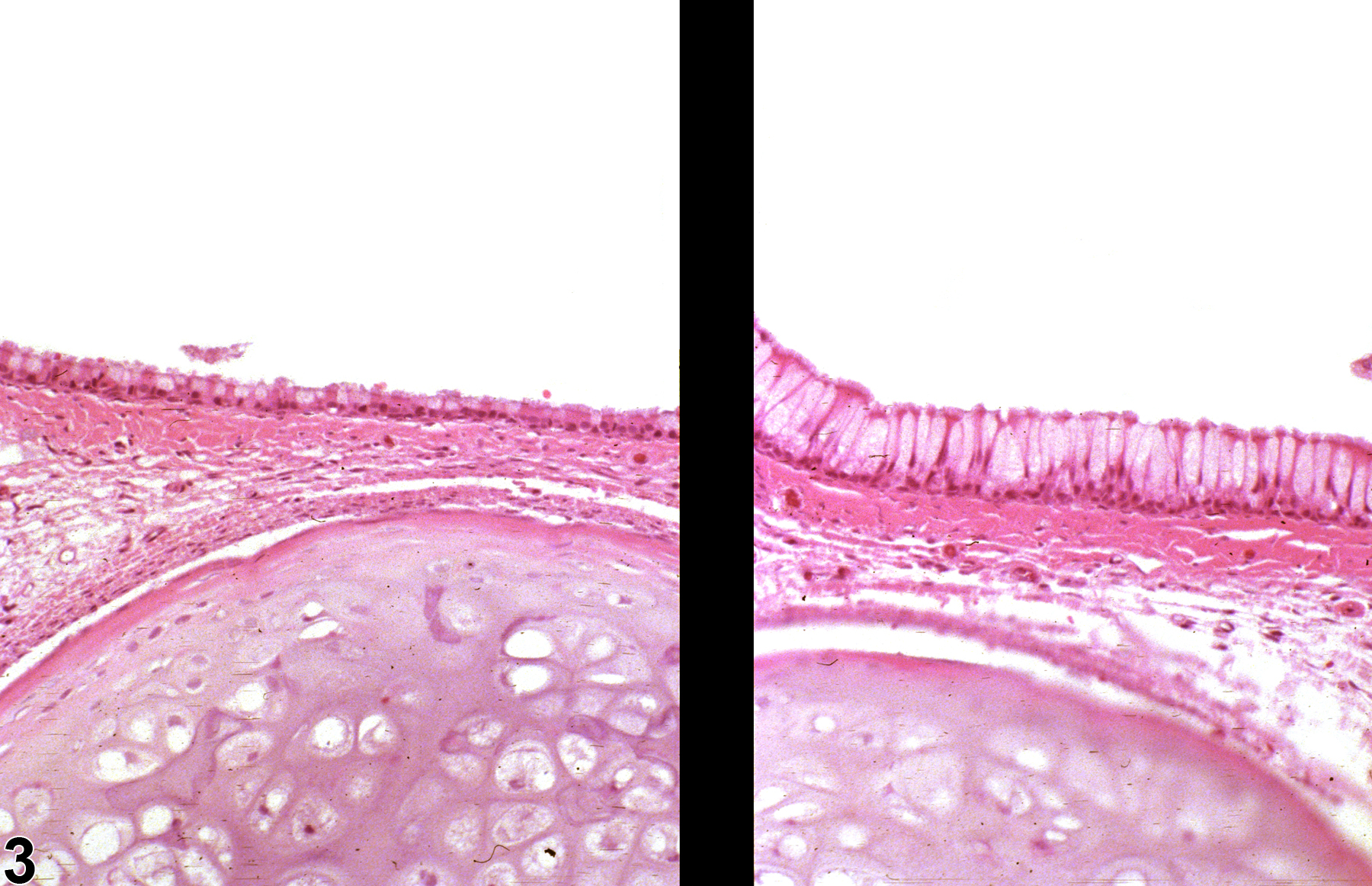 Image of hyperplasia, goblet cell in the nose, respiratory epithelium from a male F344/N rat in a subchronic study