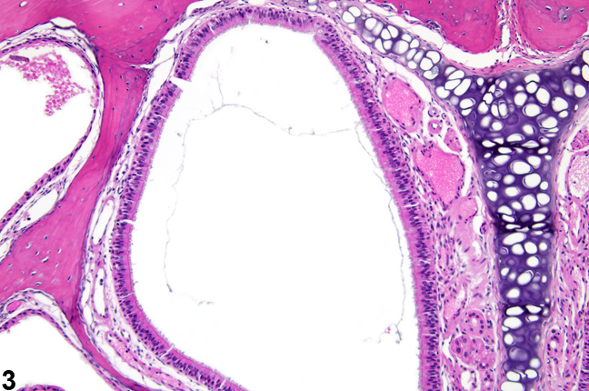 Image of normal dorsal meatus (level I) in the nose from a male B6C3F1/N mouse in a subchronic study