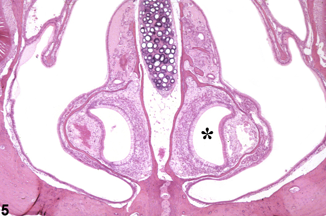Image of normal vomeronasal organ in the nose