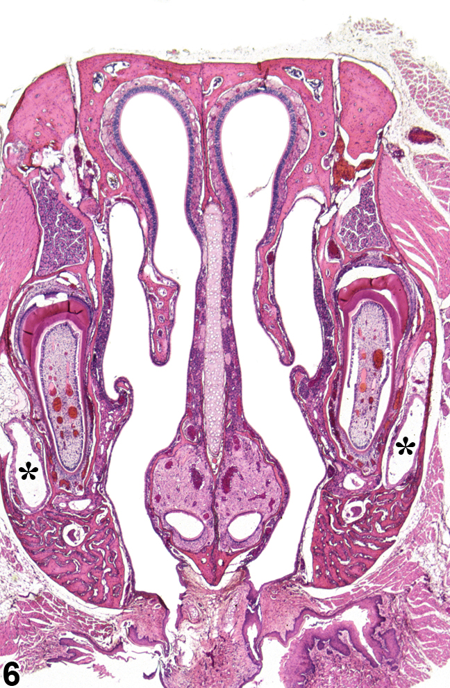 Image of normal nasal cavity (level II) in the nose from a  B6C3F1/N mouse