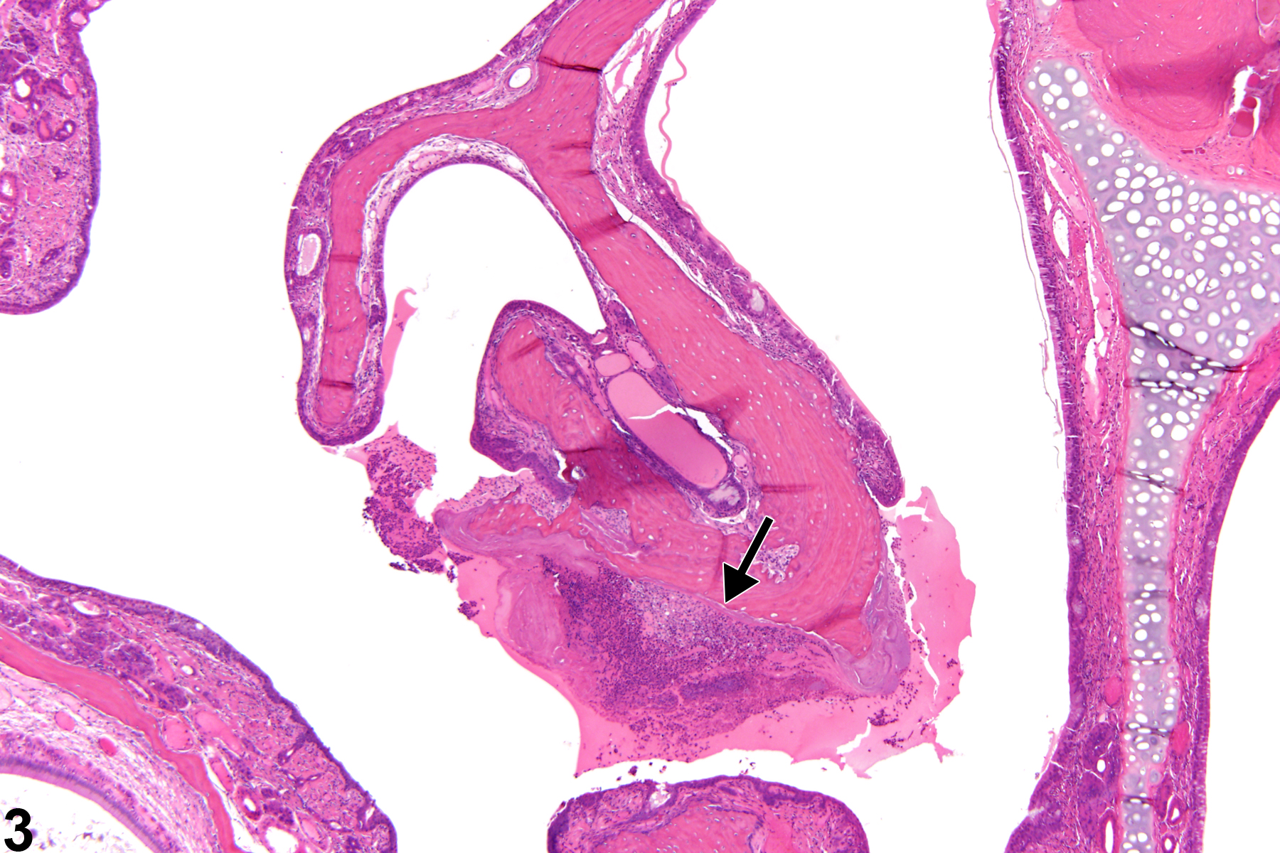 Image of inflammation in the nose, respiratory epithelium from a male F344/N rat in a chronic study