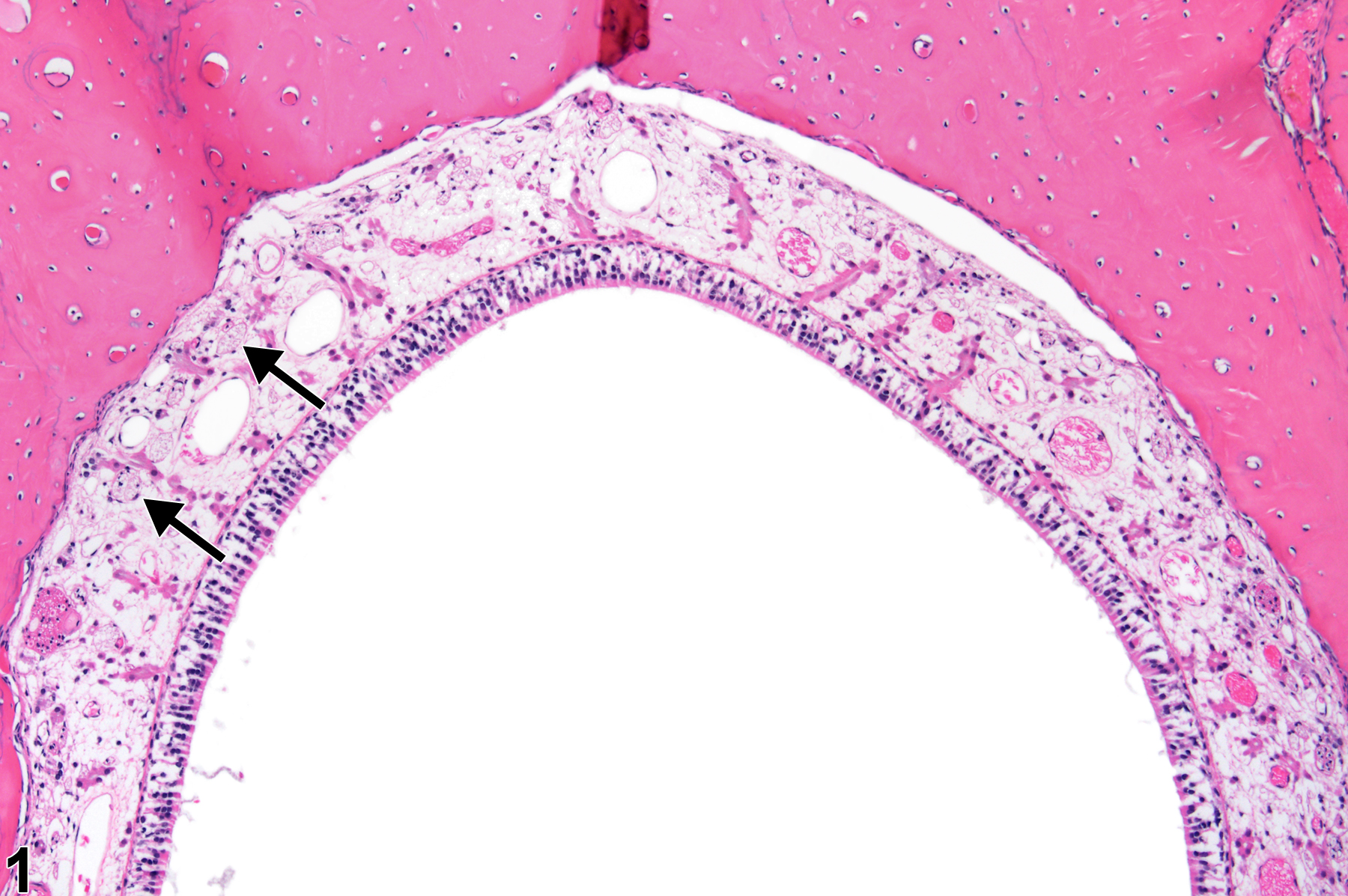 Image of atrophy in the nose, nerve from a female F344/N rat in a subchronic study