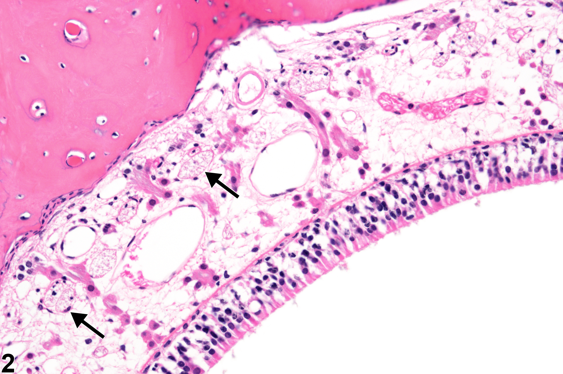 Image of atrophy in the nose from a female F344/N rat in a subchronic study