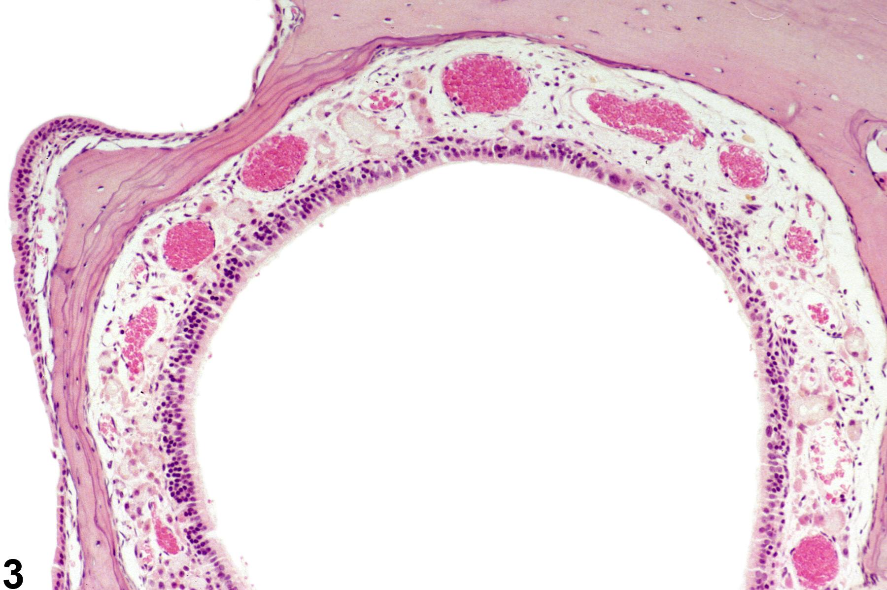 Image of atrophy in the nose from a male B6C3F1/N mouse in a chronic study