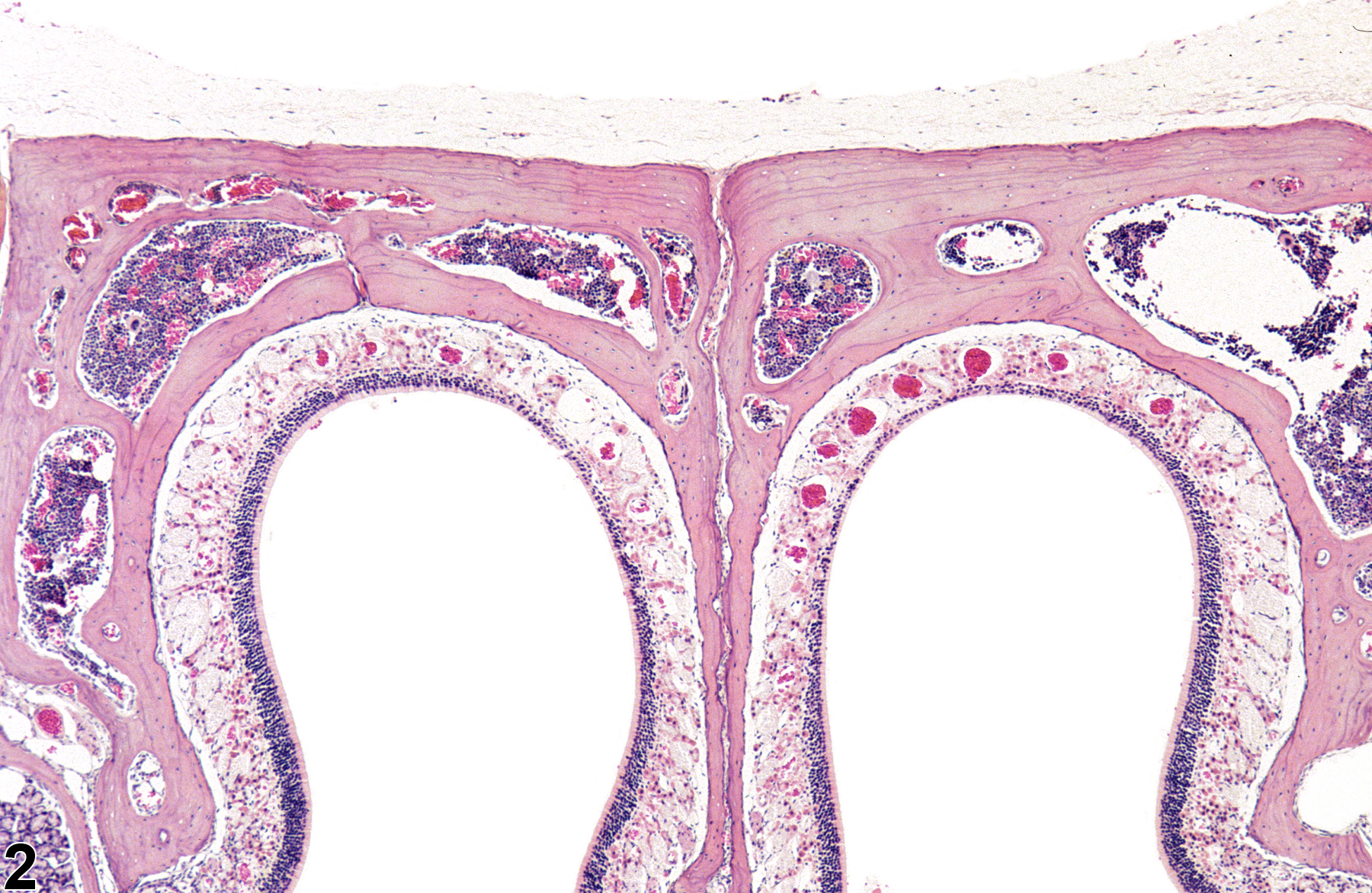 Image of atrophy in the nose, olfactory epithelium from a male B6C3F1/N mouse in a chronic study