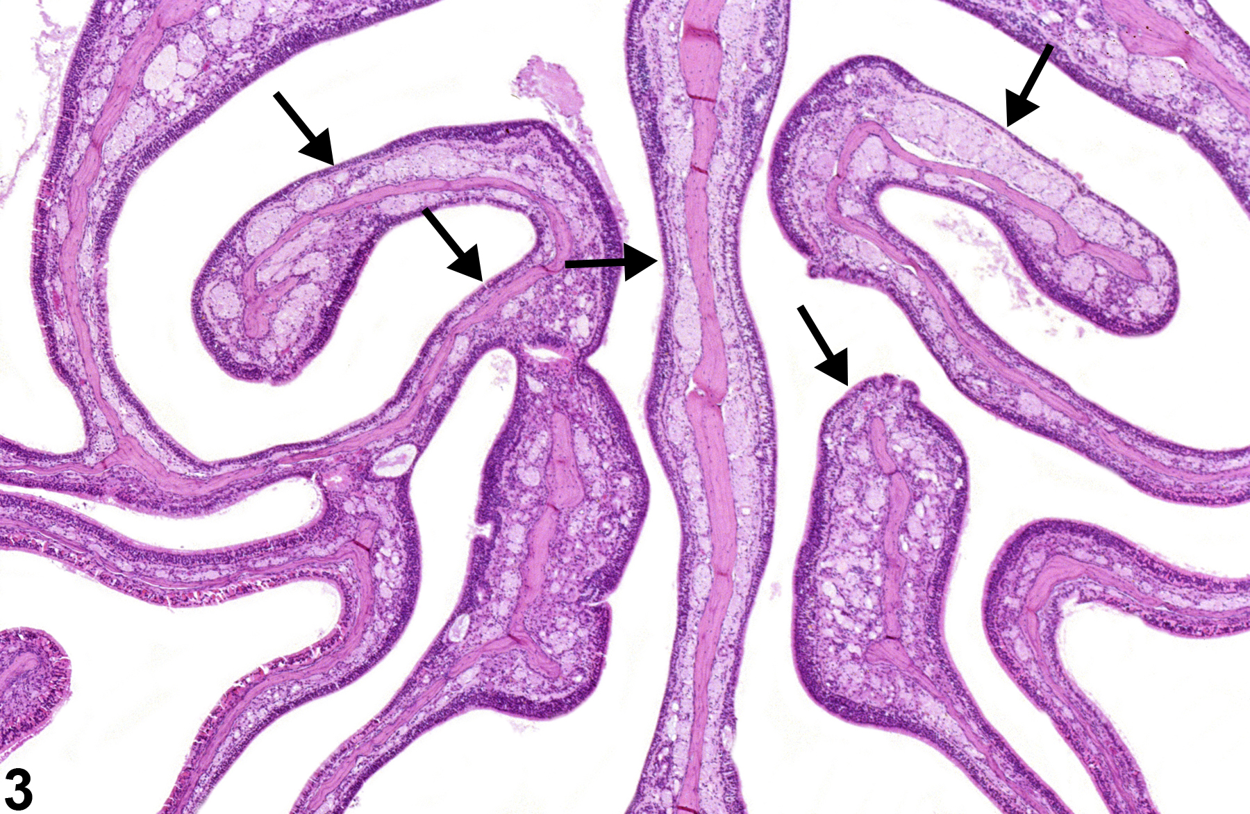 Image of atrophy in the nose, olfactory epithelium from a male F344/N rat in a chronic study
