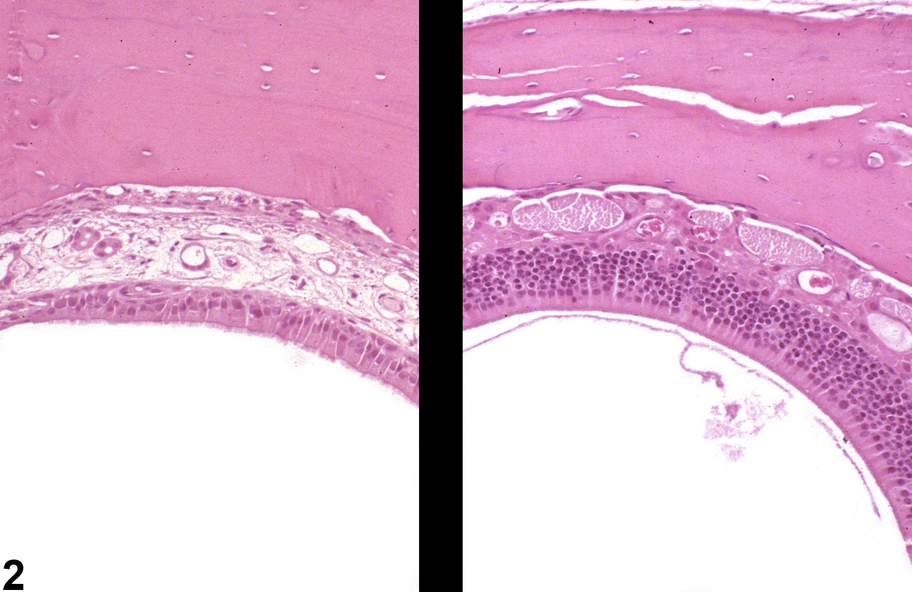 Image of metaplasia, respiratory in the nose, olfactory epithelium from a male B6C3F1/N mouse in a subchronic study