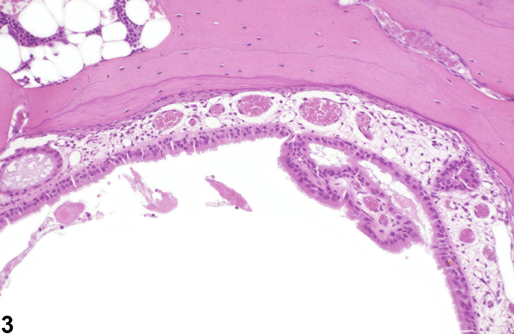 Image of metaplasia, respiratory in the nose, olfactory epithelium from a male B6C3F1/N mouse in a chronic study
