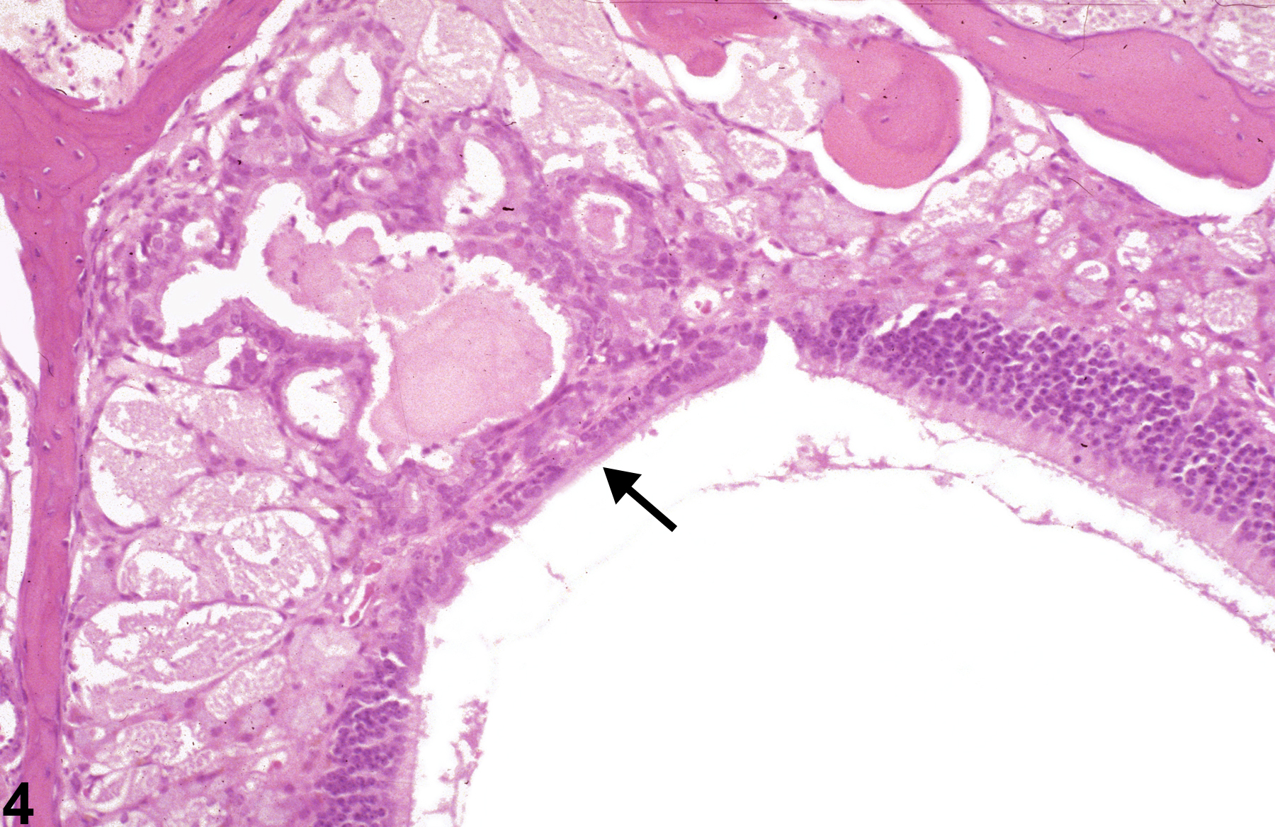 Image of metaplasia, respiratory in the nose, olfactory epithelium from a  B6C3F1/N mouse in a chronic study