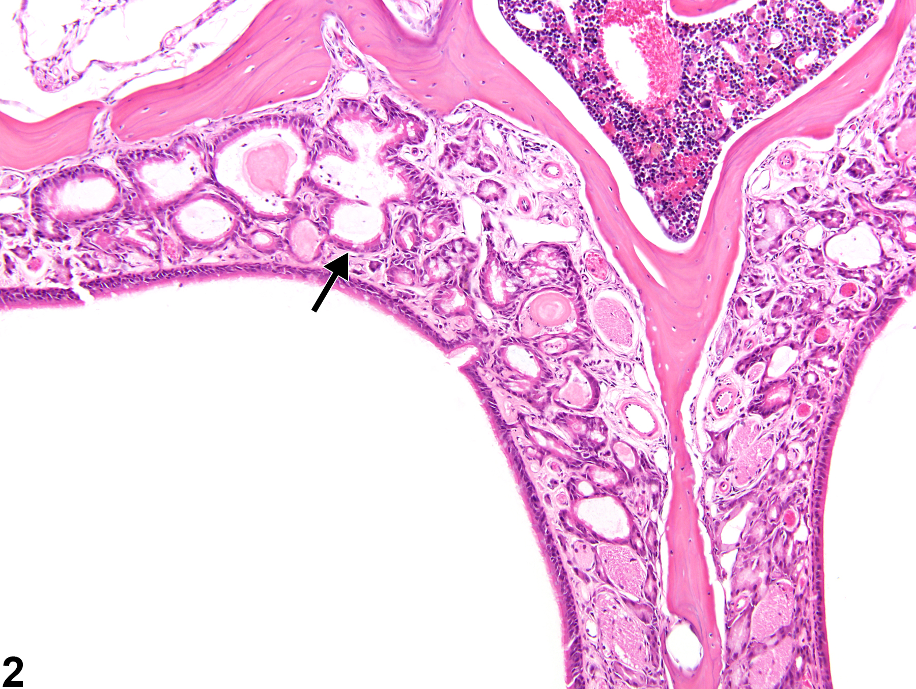Image of hyperplasia in the nose, olfactory epithelium, glands from a male B6C3F1/N mouse in a chronic study
