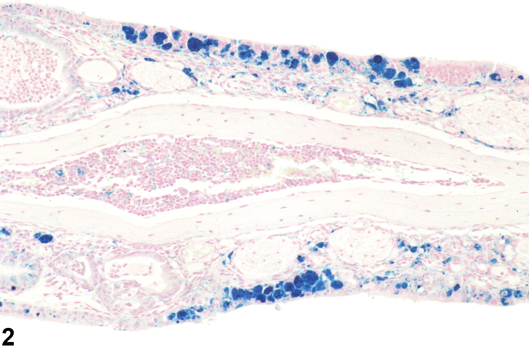 Image of pigment in the nose, respiratory epithelium from a female B6C3F1/N mouse in a subchronic study