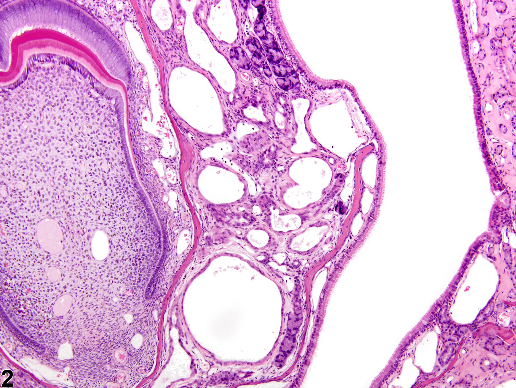 Image of dilation in the nose, respiratory epithelium, glands from a male B6C3F1/N mouse in a chronic study