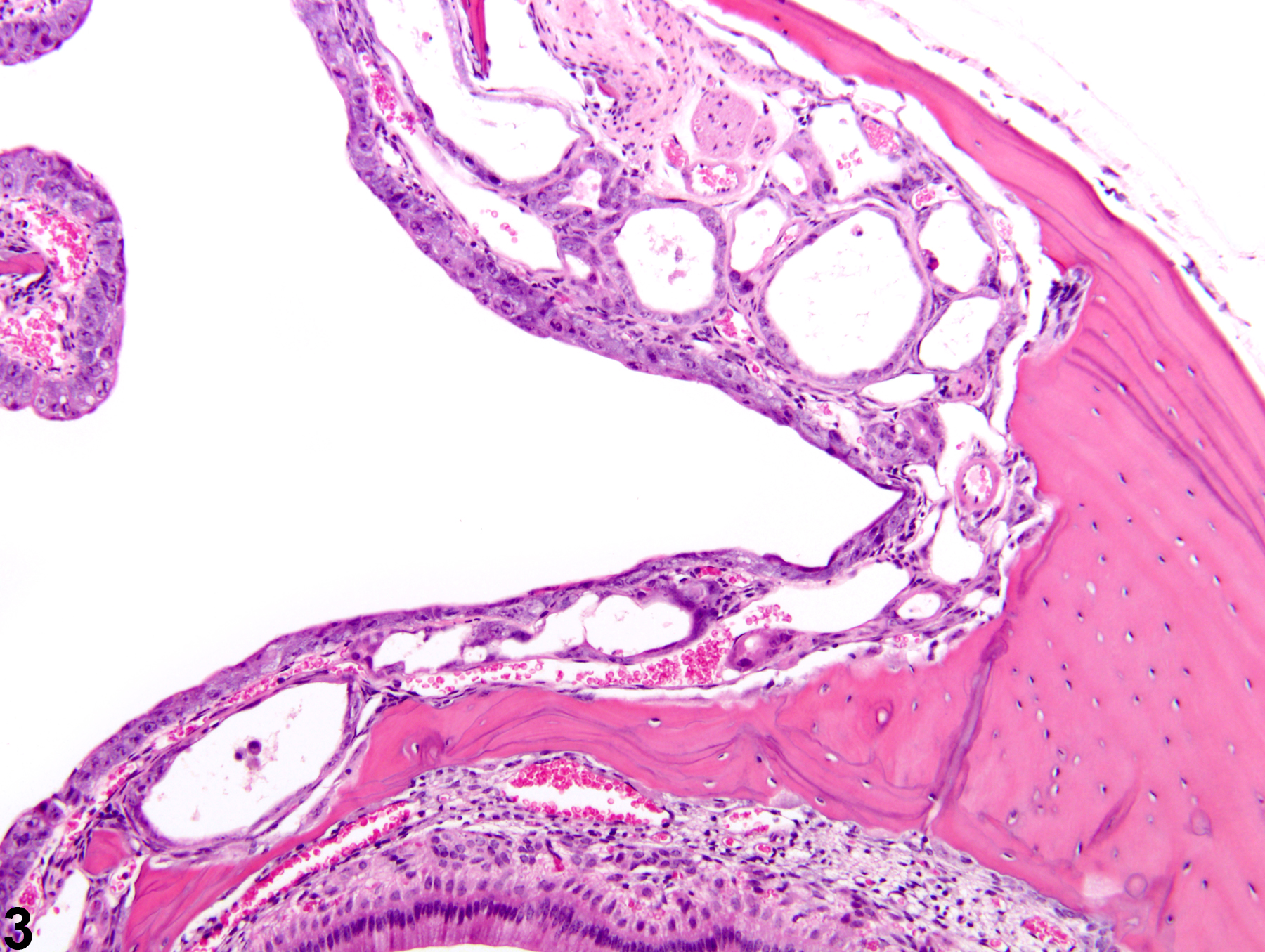 Image of dilation in the nose, respiratory epithelium, glands from a female B6C3F1/N mouse in a chronic study
