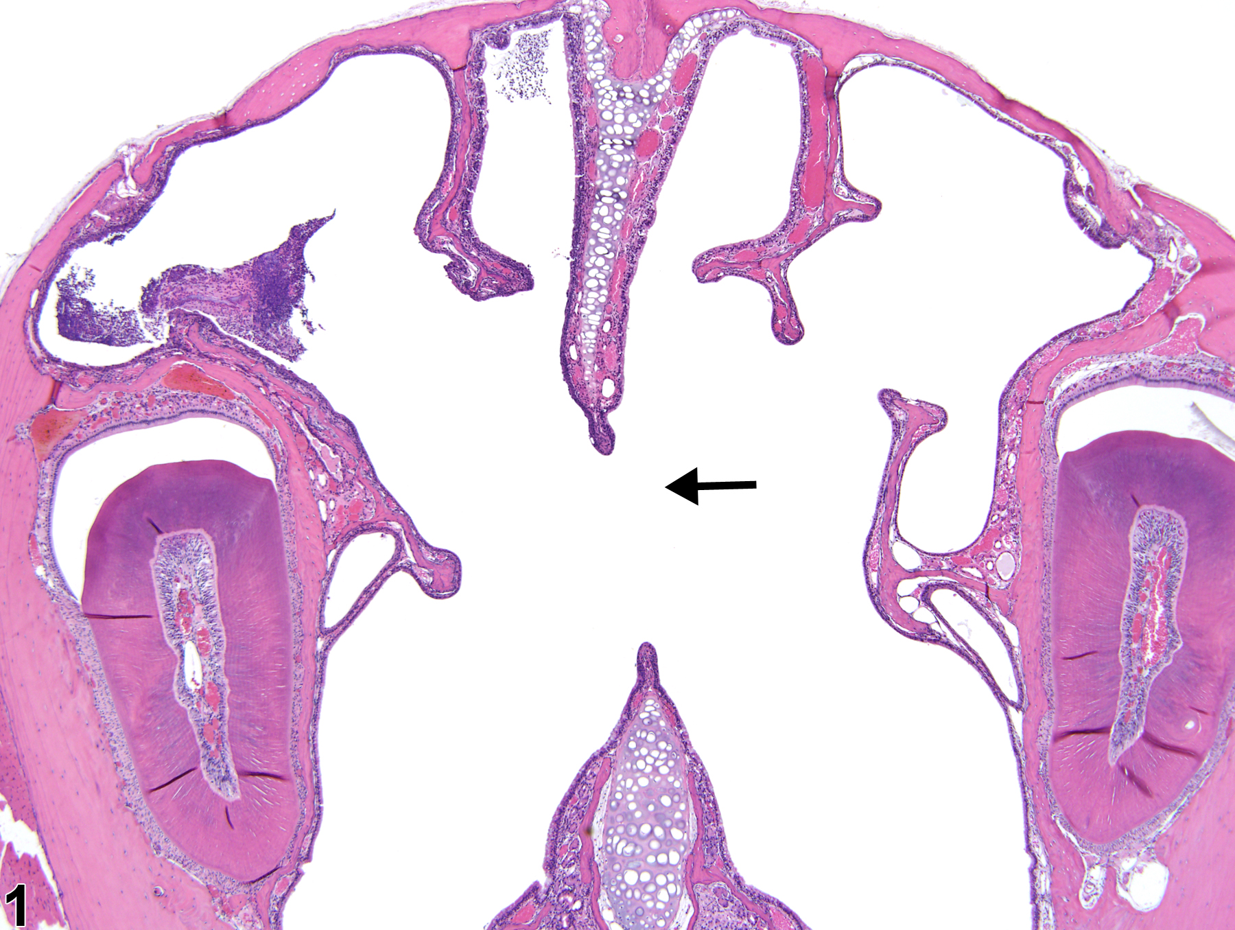 Image of perforation in the nose, septum from a female B6C3F1/N mouse in a chronic study