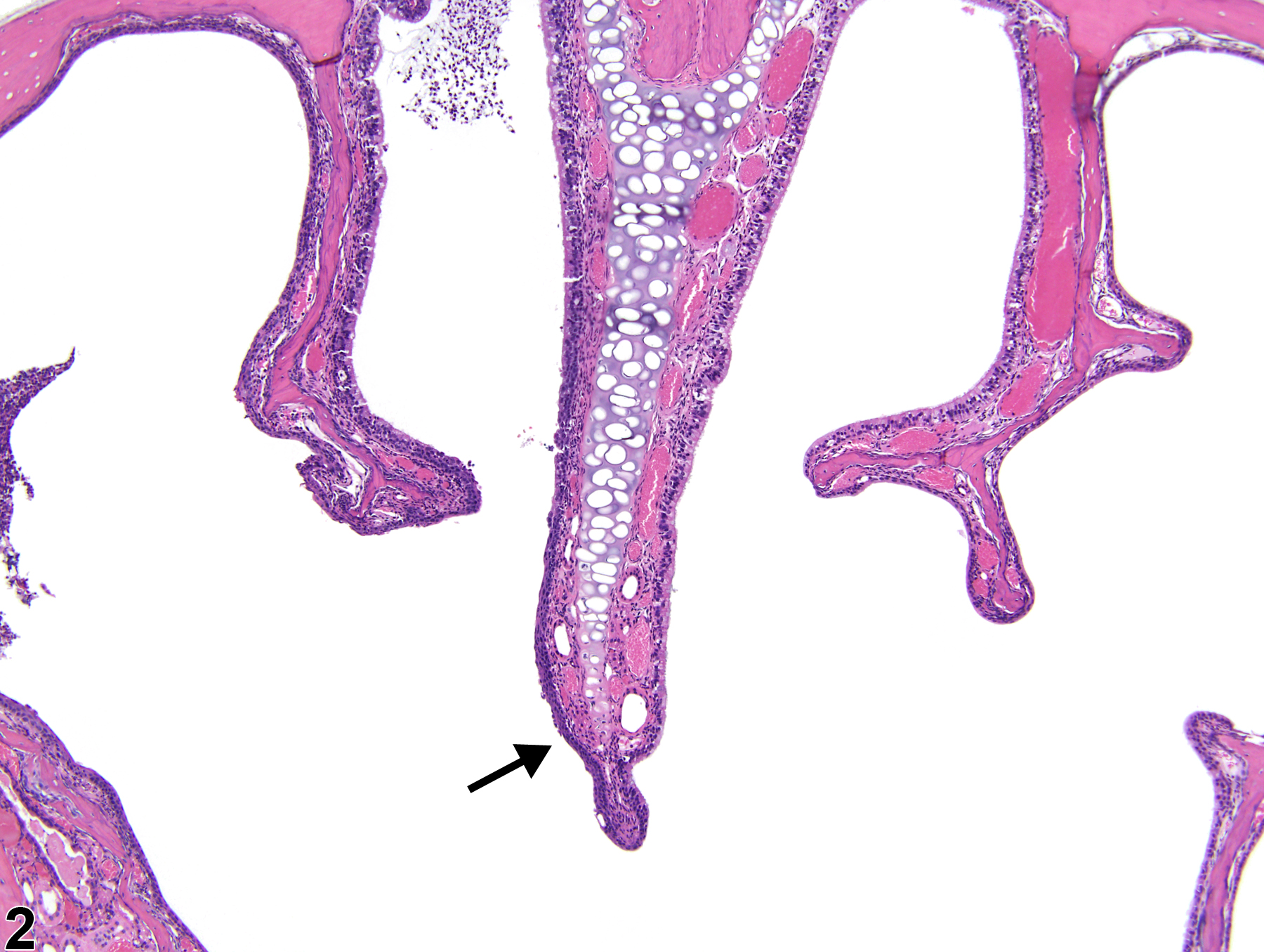 Image of perforation in the nose, septum from a female B6C3F1/N mouse in a chronic study