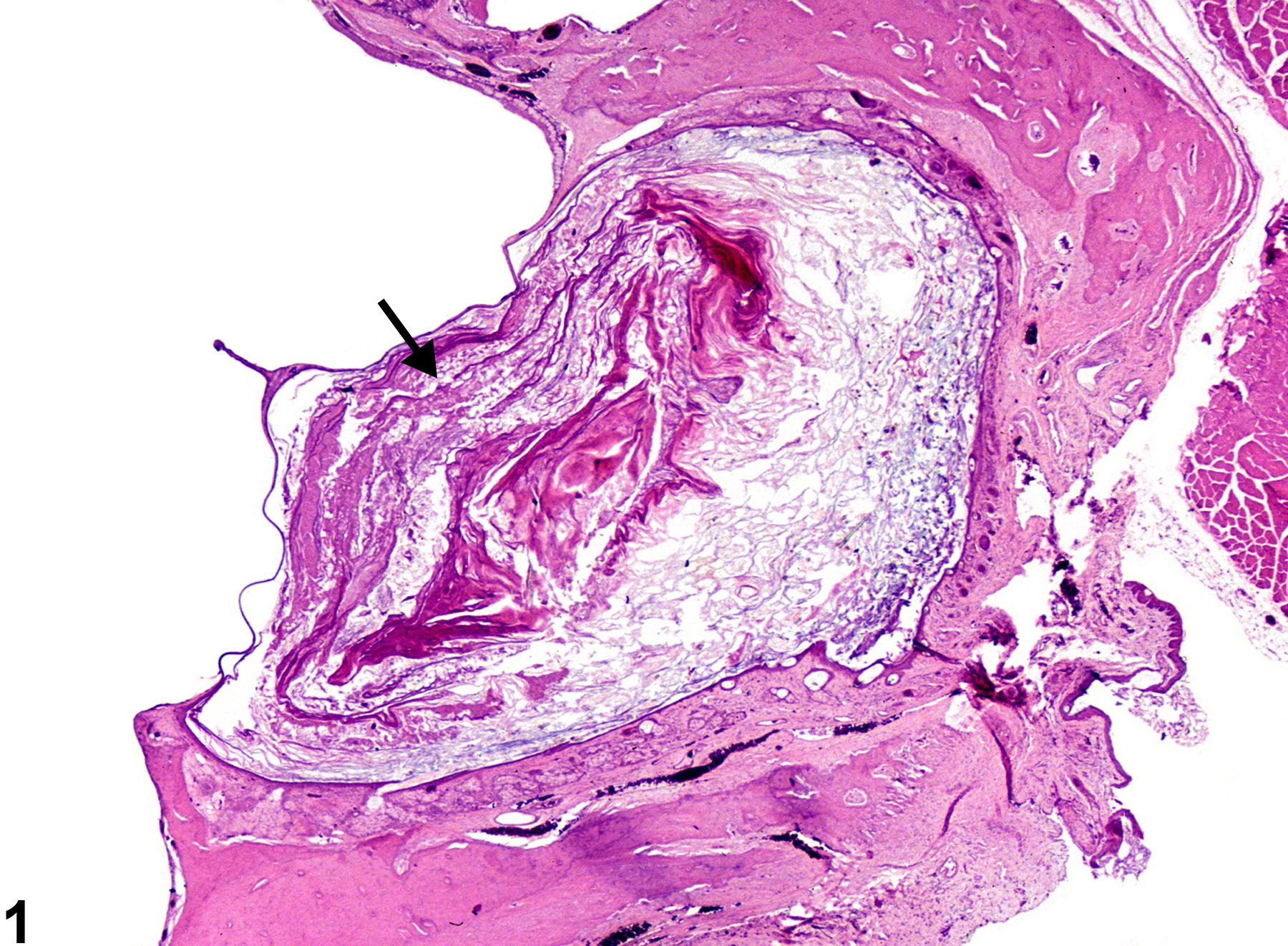 Image of canal dilation in the ear from a male F344/N rat in a chronic study