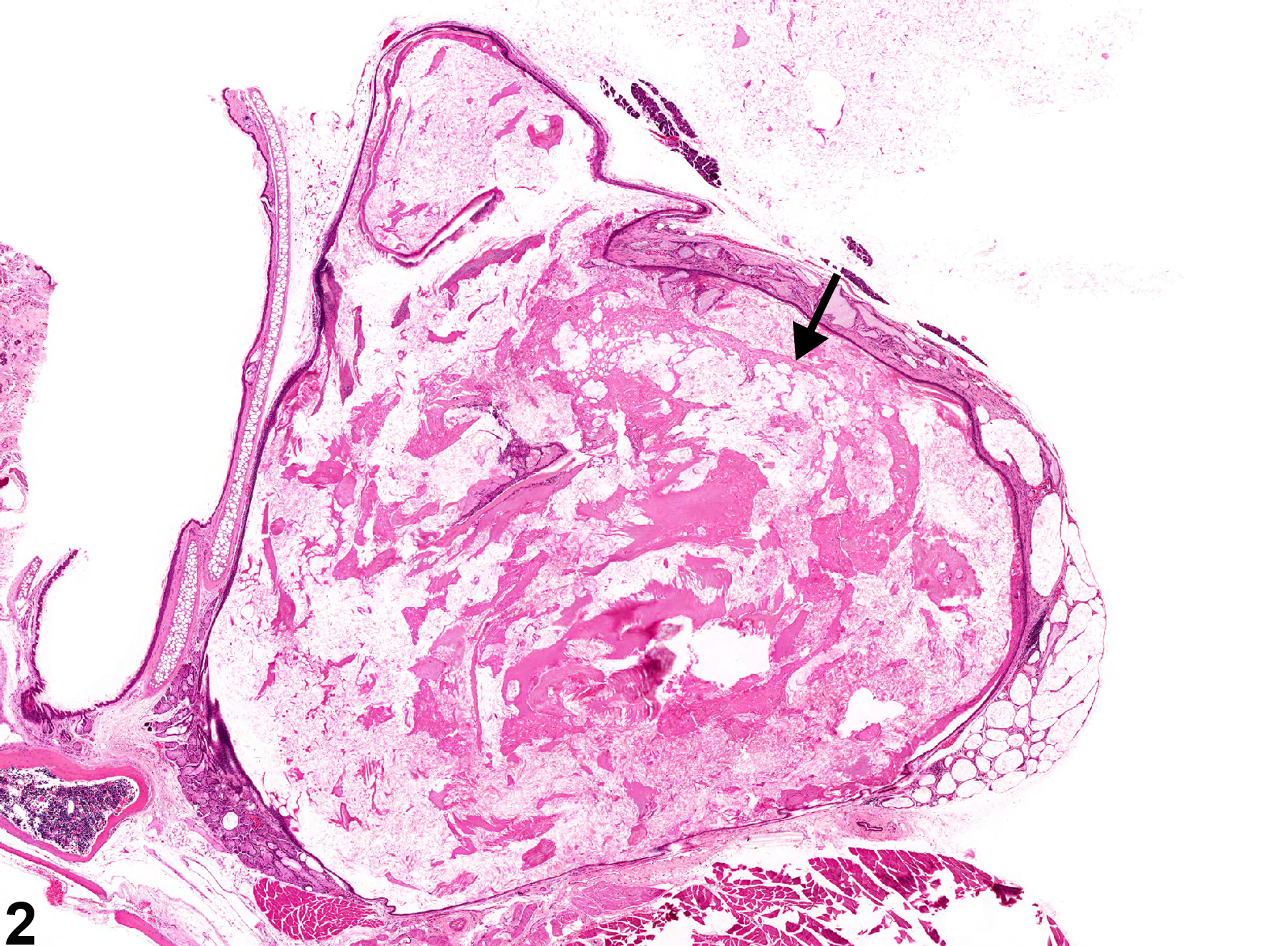 Image of canal dilation in the ear from a male B6C3F1 mouse in a chronic study