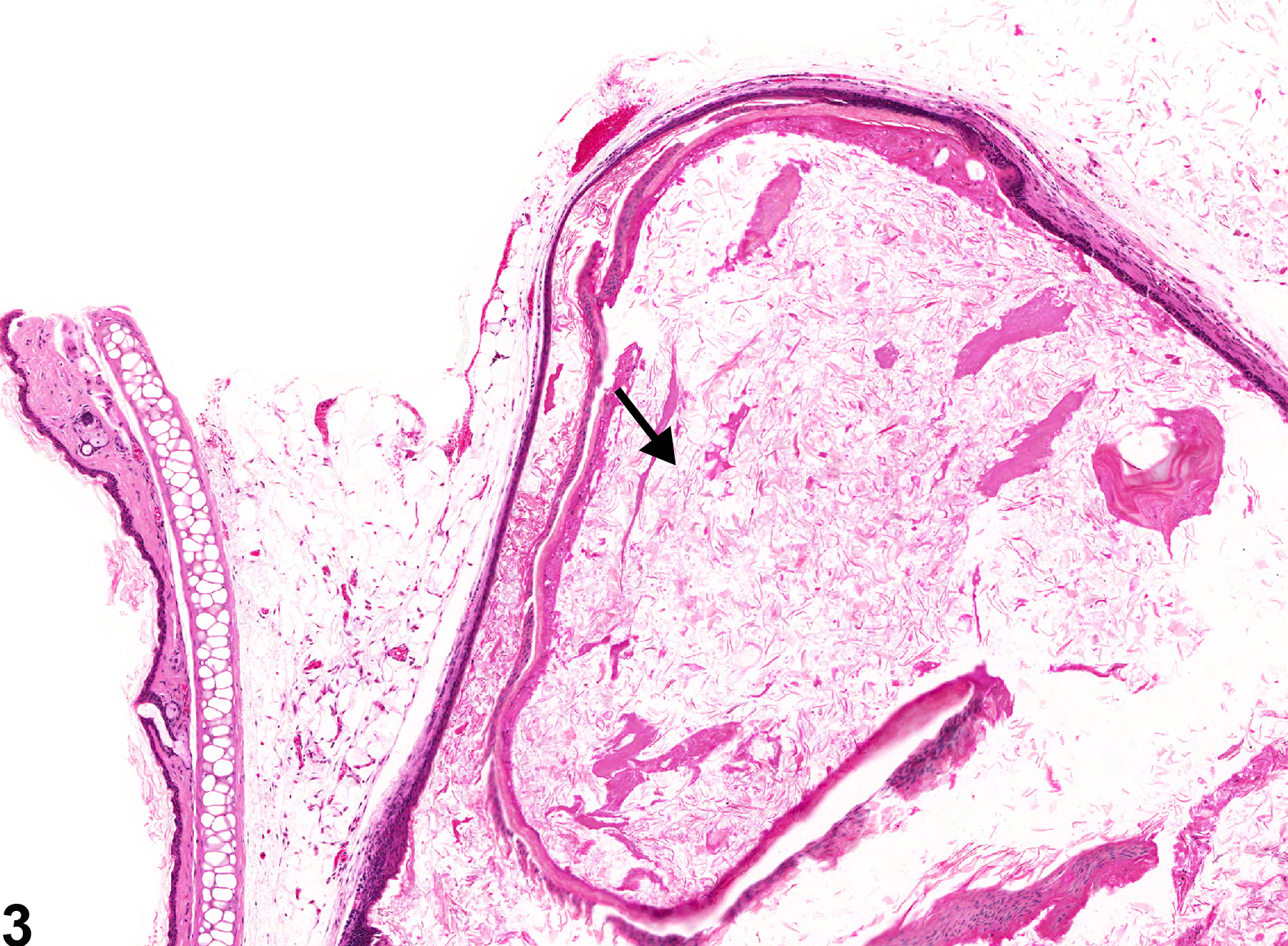 Image of canal dilation in the ear from a male B6C3F1 mouse in a chronic study
