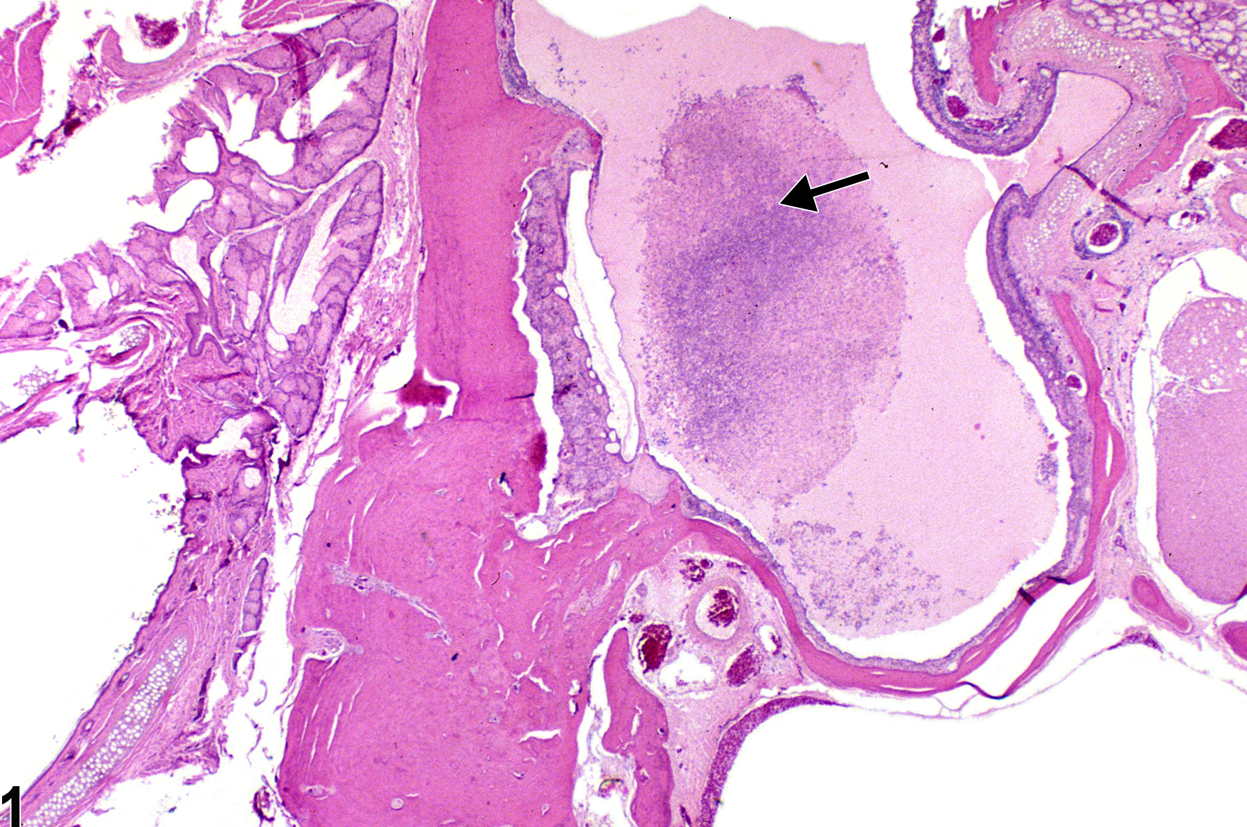 Image of inflammation in the ear from a male F344/N rat in a chronic study