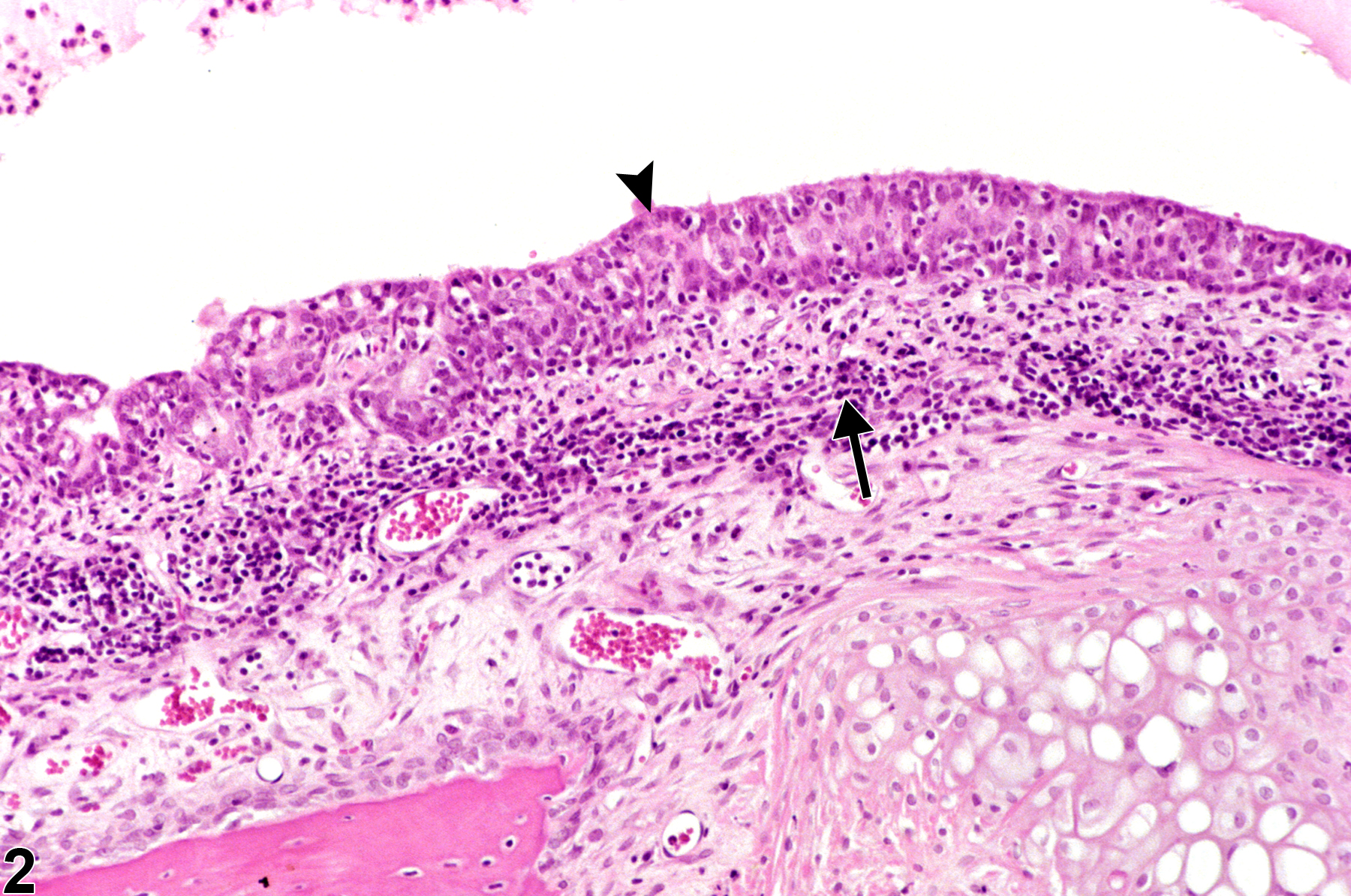 Image of inflammation in the ear from a male F344/N rat in a chronic study