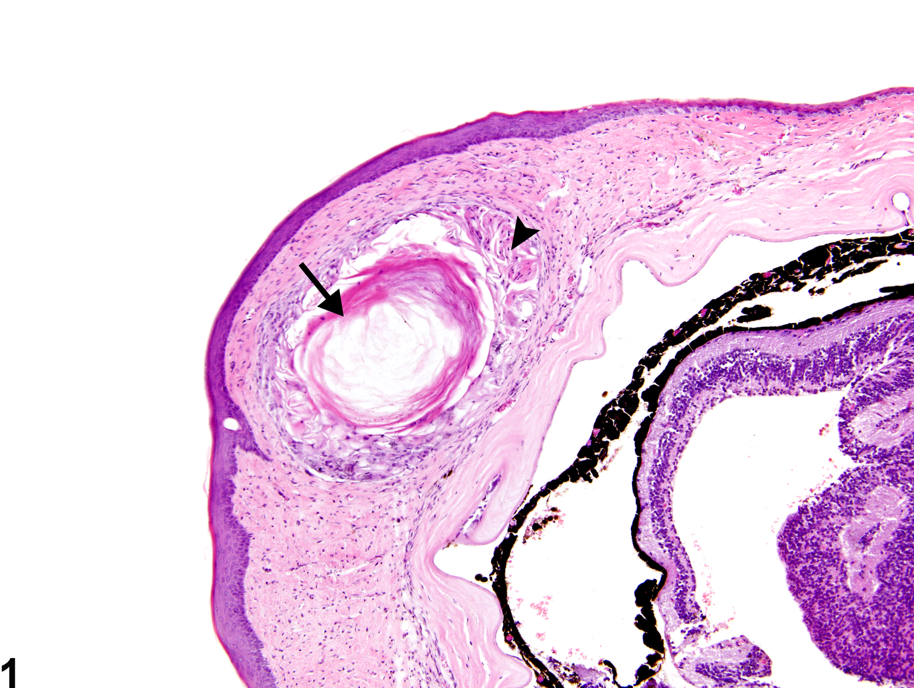 Image of cornea cyst in the eye from a male B6C3F1 mouse in a chronic study